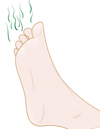 stinkende voeten