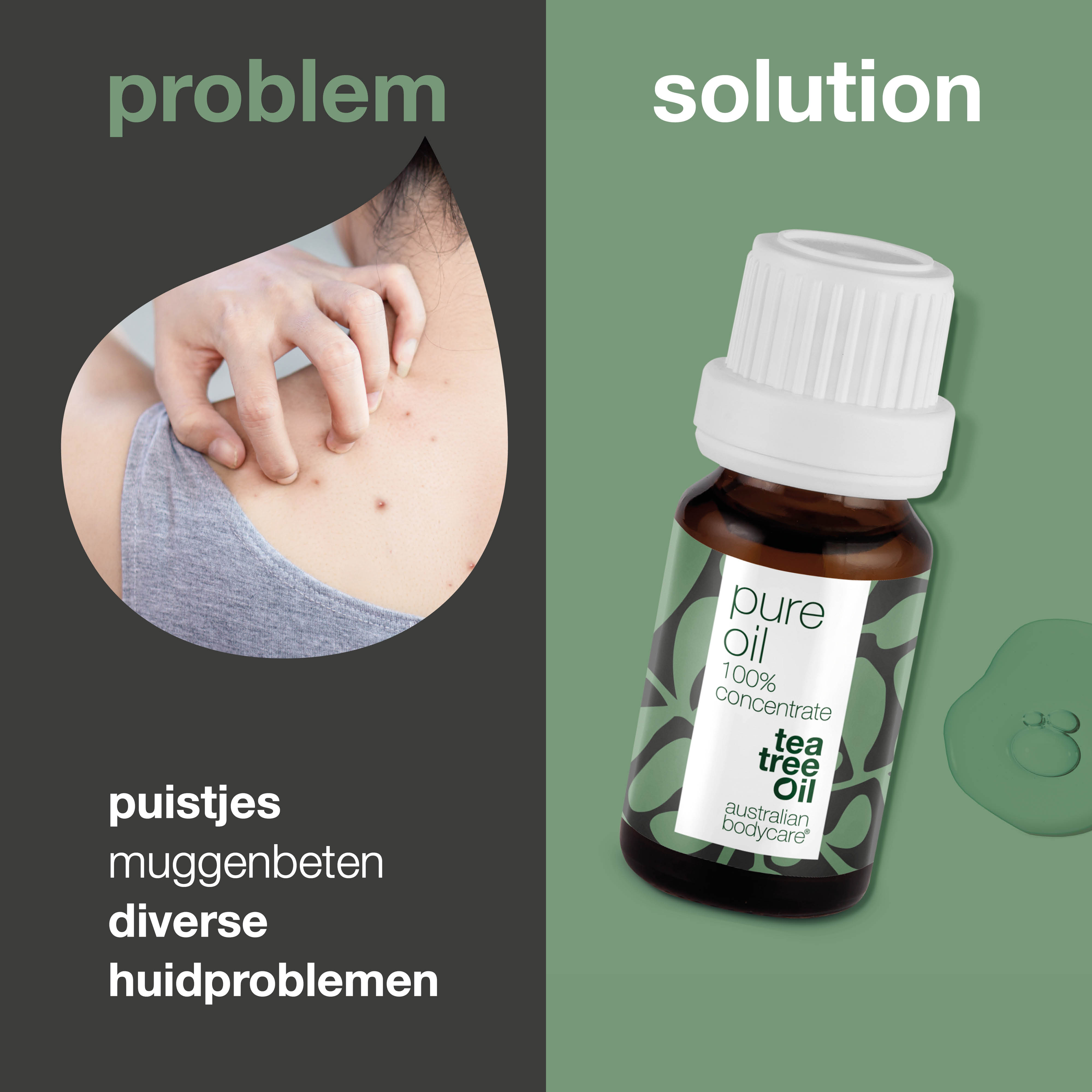 100% Pure Australische Tea Tree Olie — natuurlijke Tea Tree Oil uit Australië
