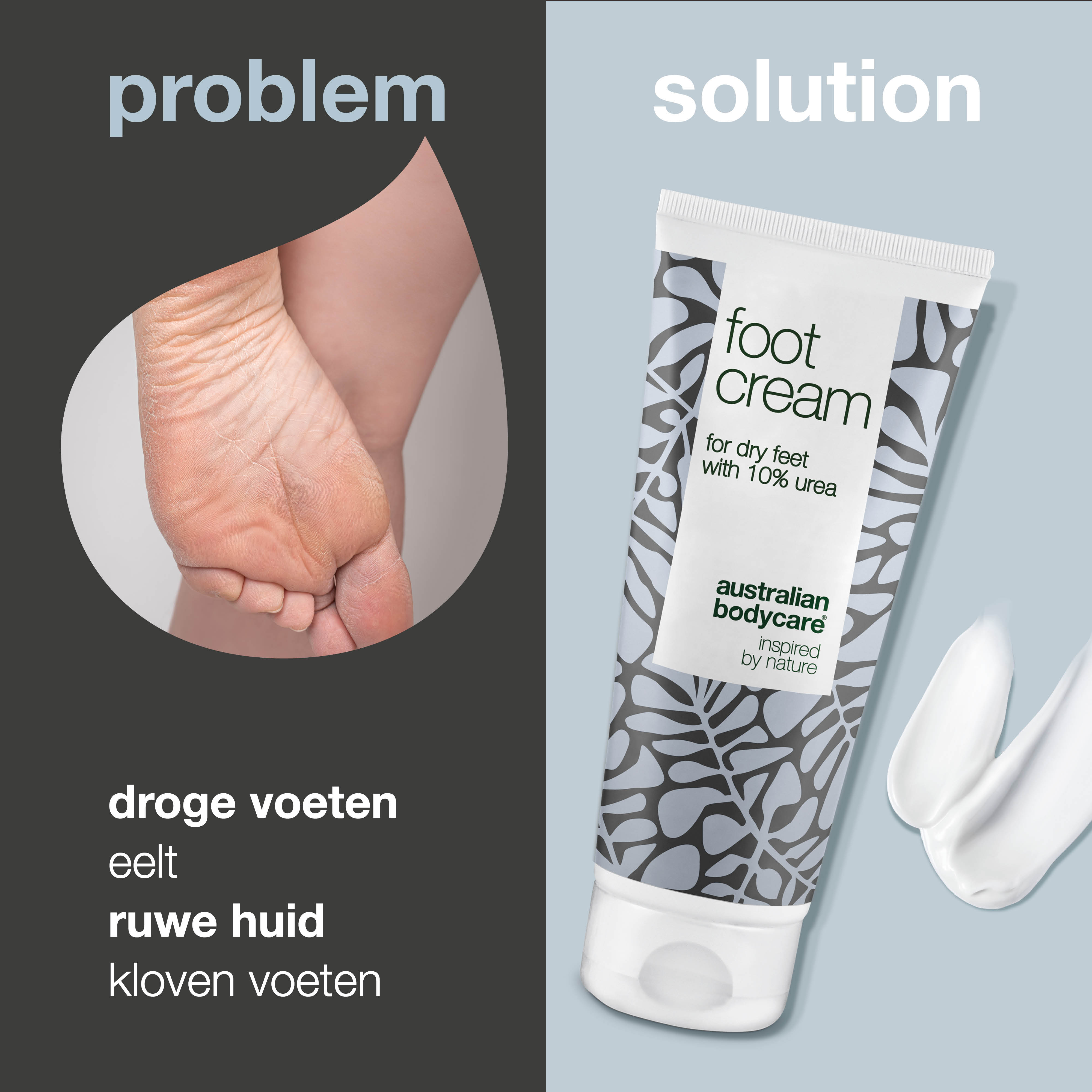 Voetencrème met 10% Ureum — Voor de dagelijkse verzorging van droge voeten