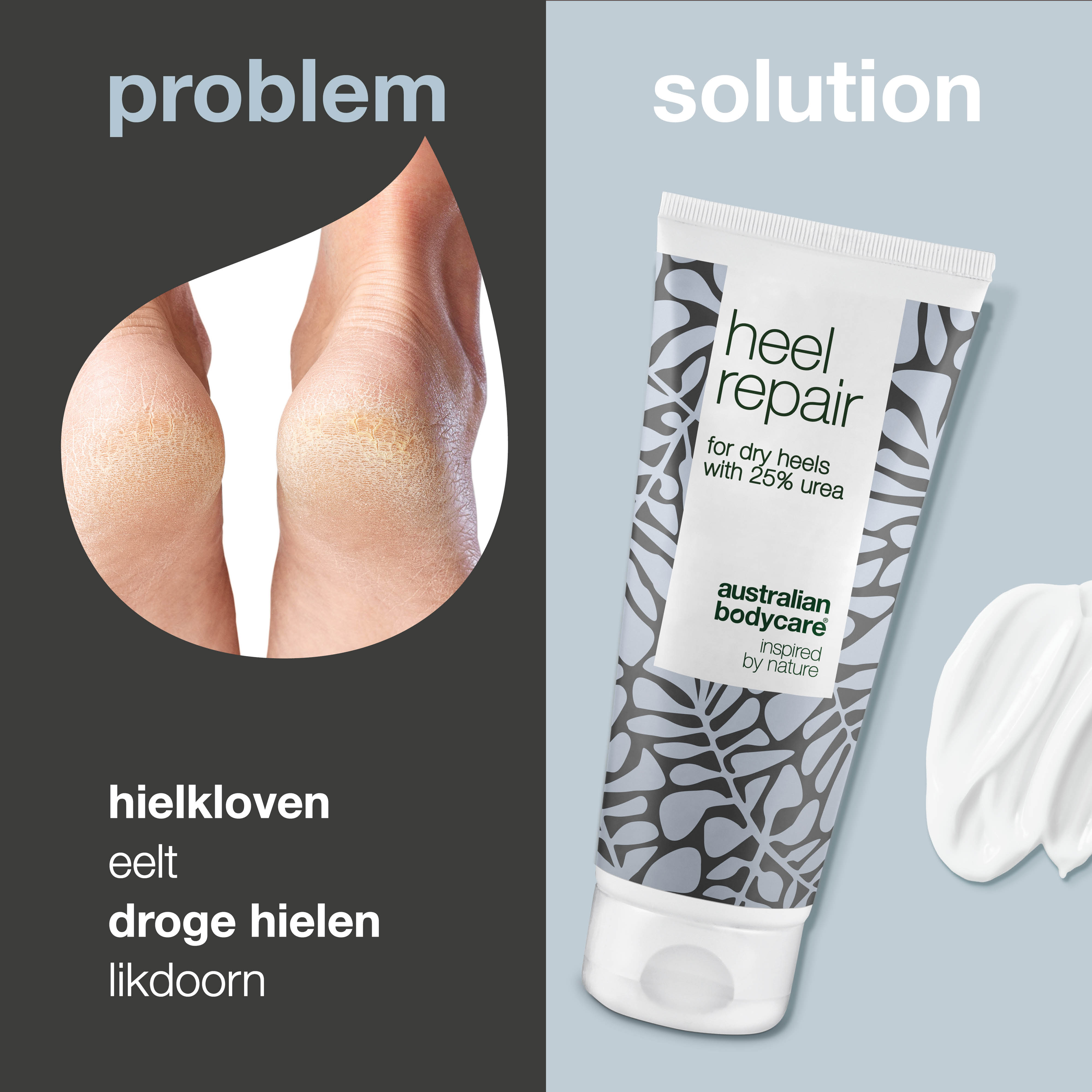 Hielkloven Crème met 25% Ureum — Intensieve hielcrème voor droge hielen en hielkloven