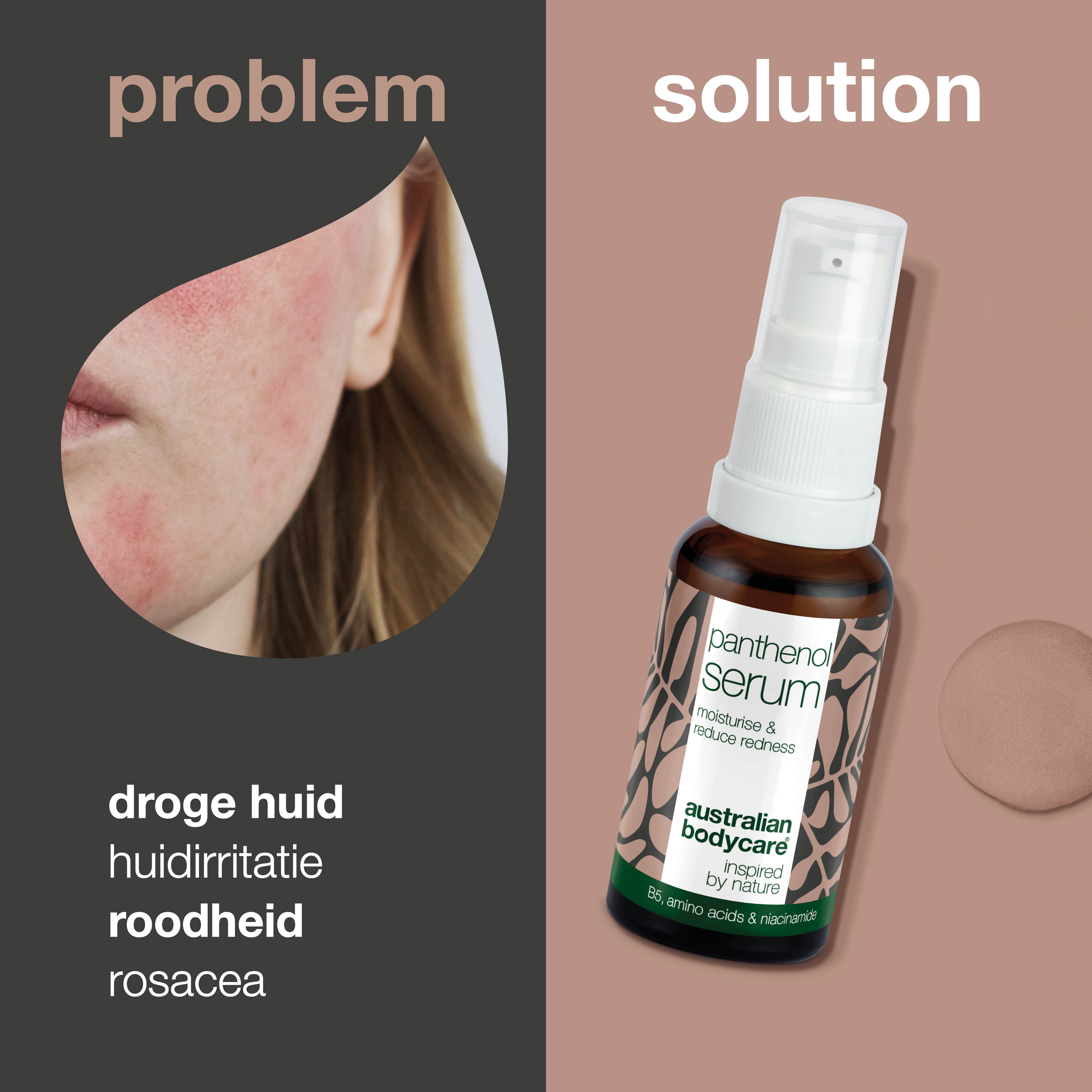 Panthenol serum voor een gevoelige huid en roodheid — Serum met provitamine B5 & niacinamide verzacht roodheid & rosacea