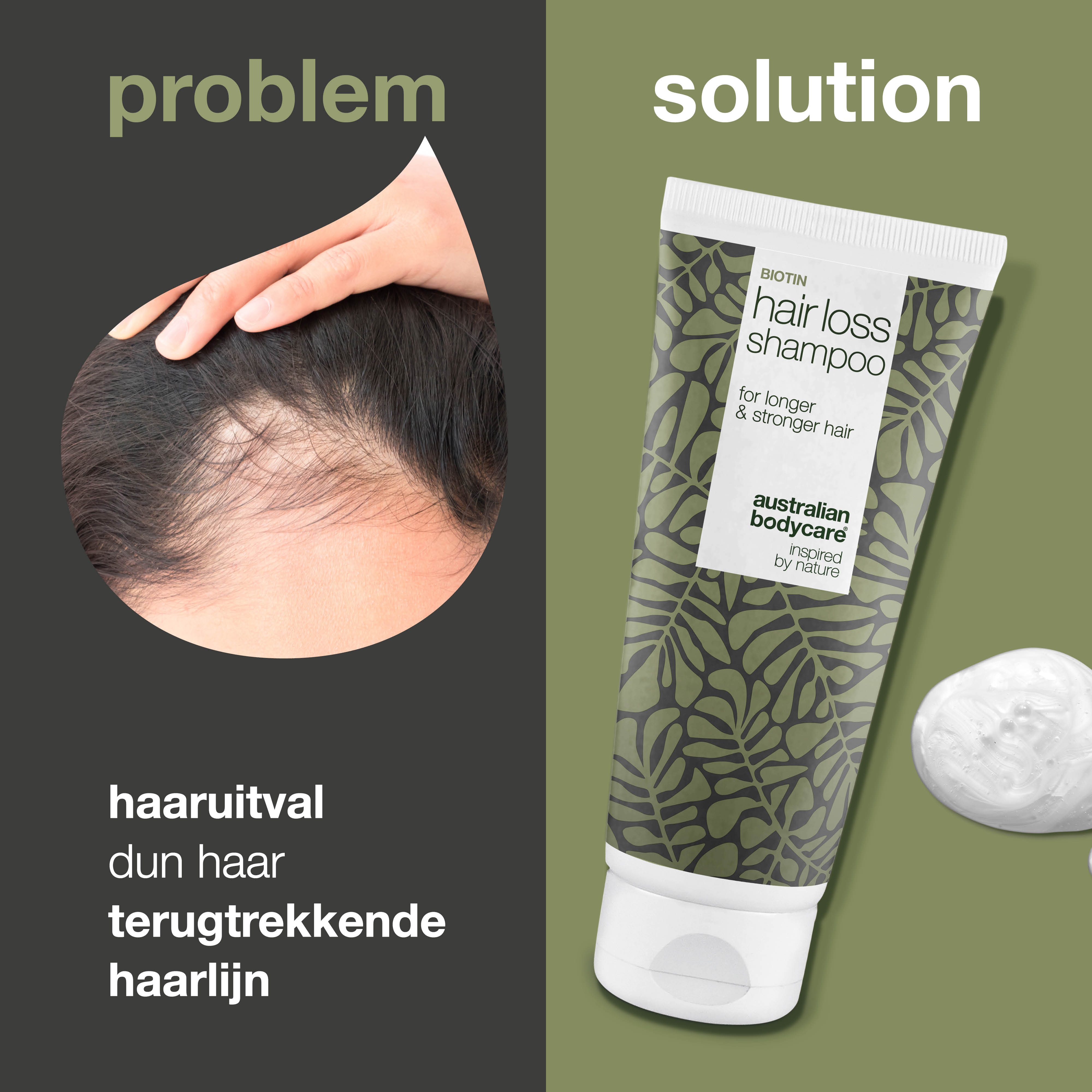 Haaruitval Biotine Shampoo — Voor fijn en dun haar - kan gebruikt door mensen met haaruitval