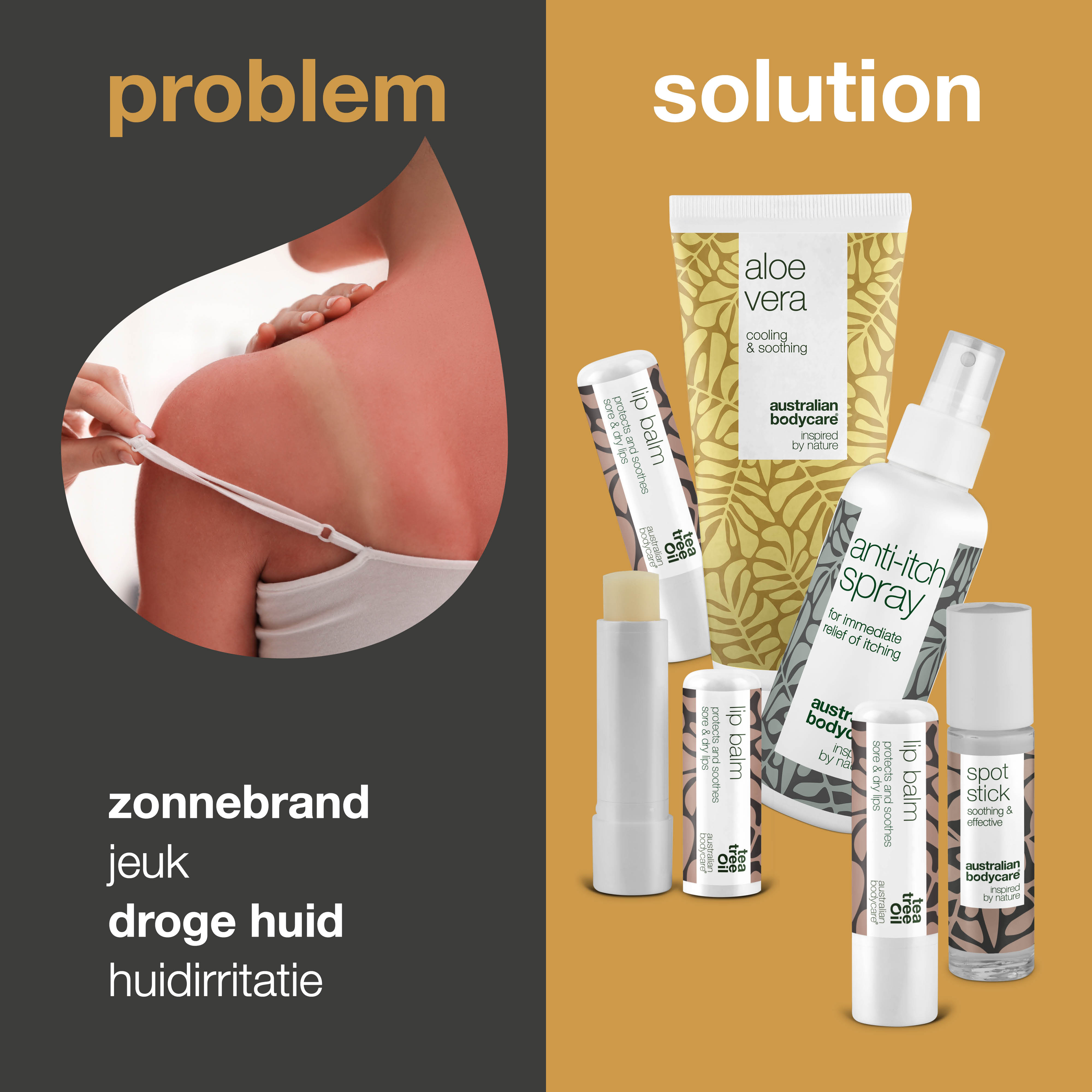 Zomerproducten — Producten voor de verzorging bij zonnebrand of andere huidproblemen