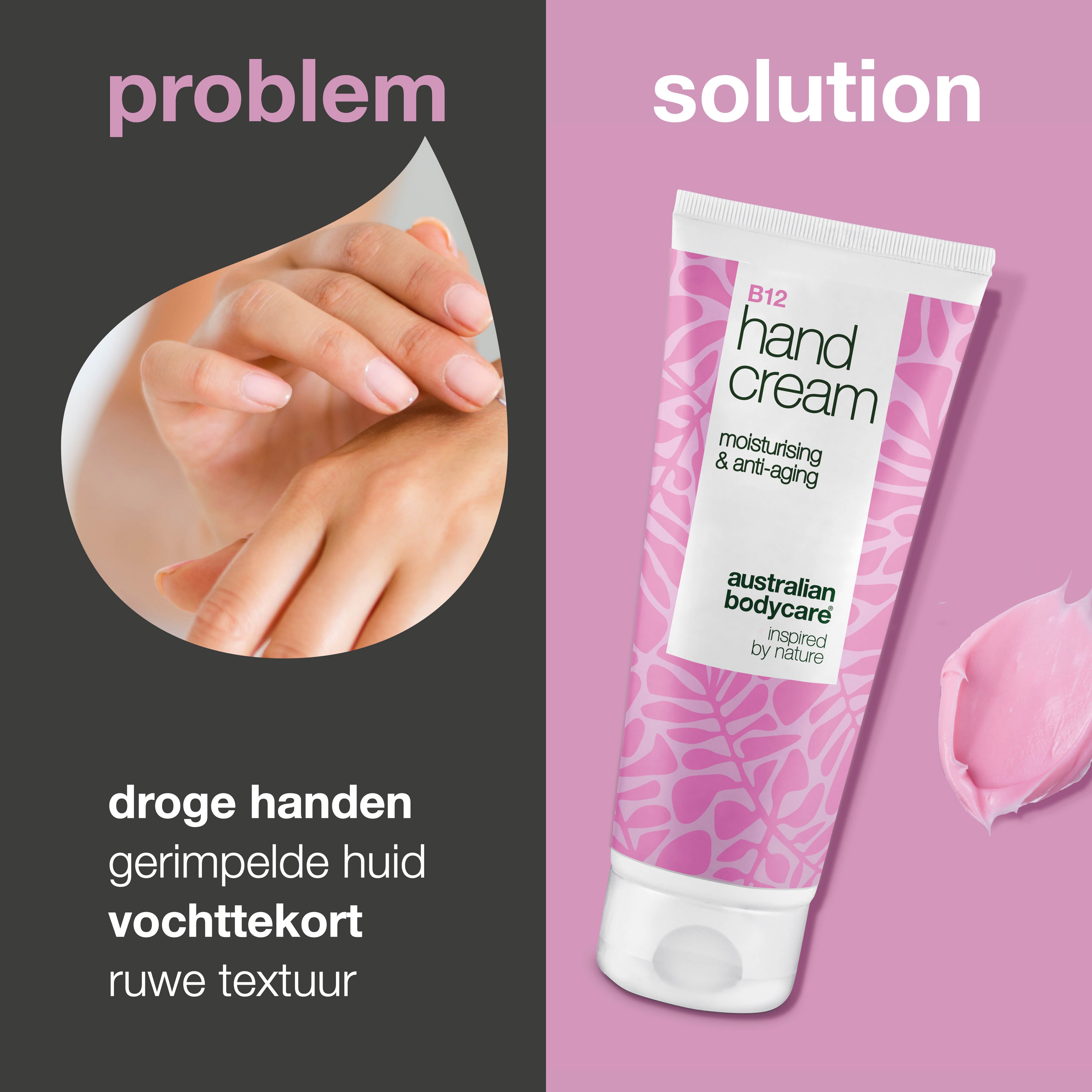 B12 Handcrème voor droge en gerimpelde handen – Hydratatie — Krijg gladde, zachte handen met B12 Handcrème. Vermindert droogte en rimpels met intensieve hydratatie.