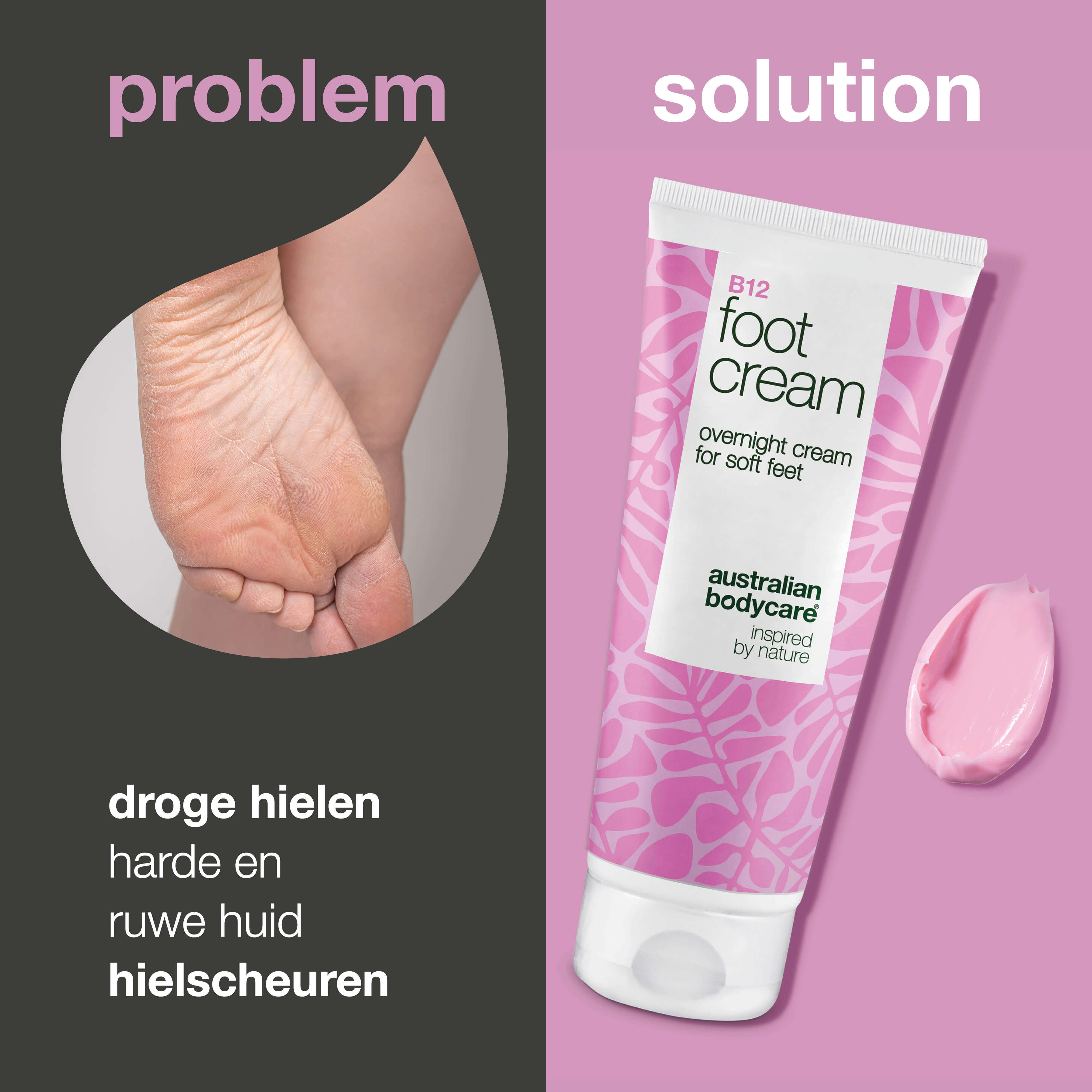 Voetcrème met B12-vitamine – verzacht en hydrateert — Voetcrème met B12-vitamine en 10% ureum voor droge voeten. Hydrateert en verzacht de huid. Perfect als nachtcrème of na een voetenbad.