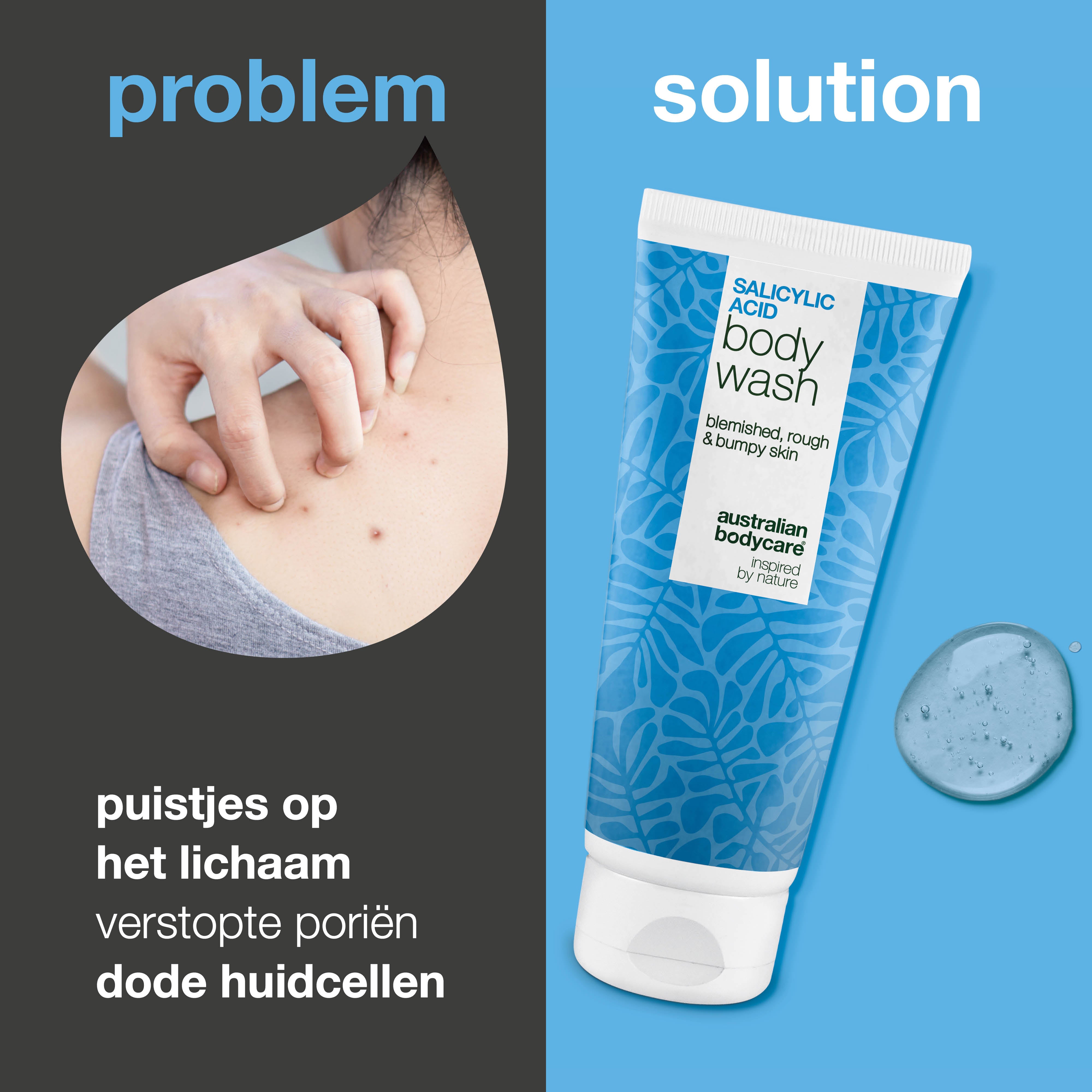 Salicylzuur Body Wash helpt bij een onzuivere huid op rug, billen en borst. Reinigt diep en bevat salicylzuur, niacinamide en zink PCA.