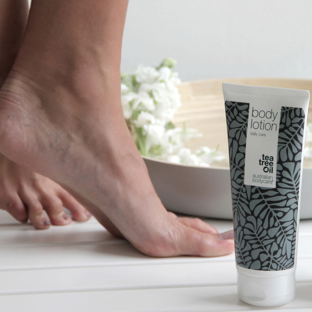 Anti–Puistjes Body Lotion - Verzorgt en voorkomt een droge, jeukende en onzuivere huid