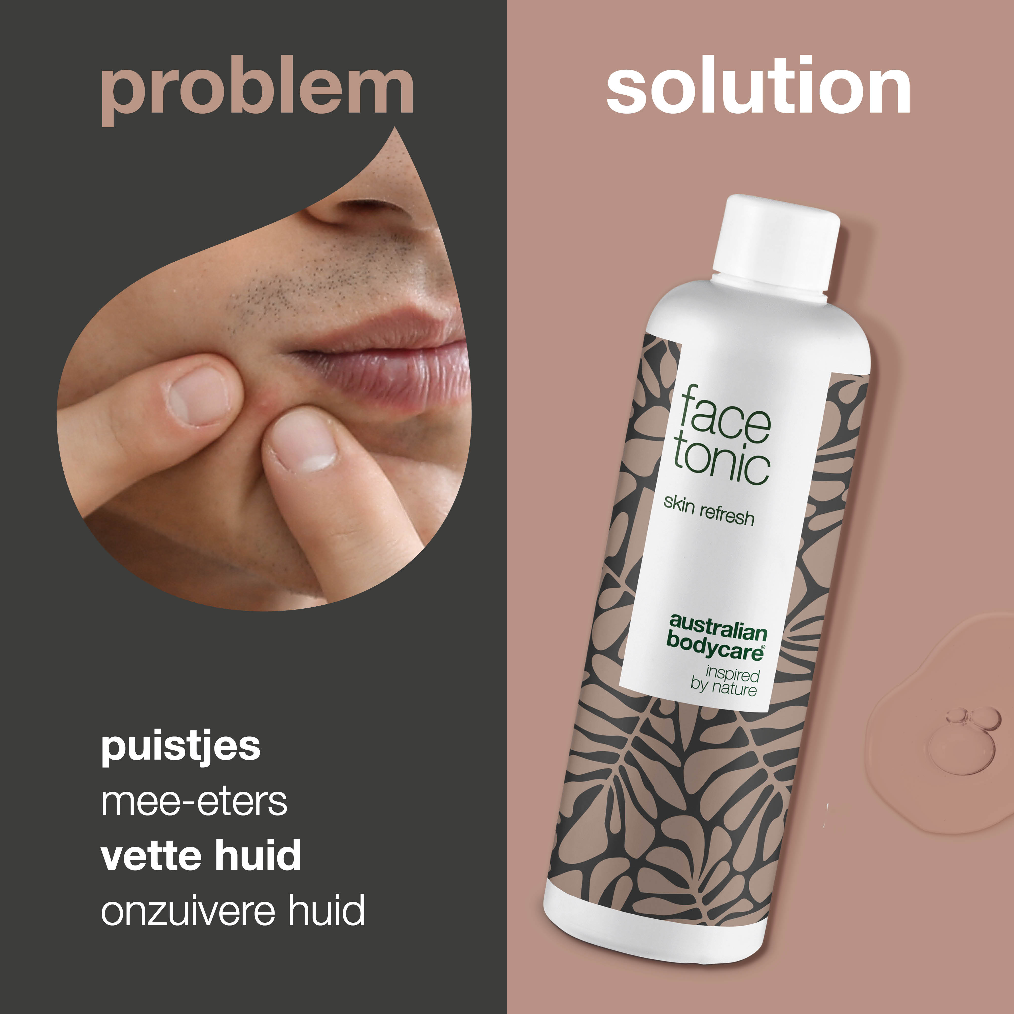Anti-Puistjes Gezichtstonic — Alcoholvrije face tonic met Tea Tree Olie tegen puistjes en mee-eters