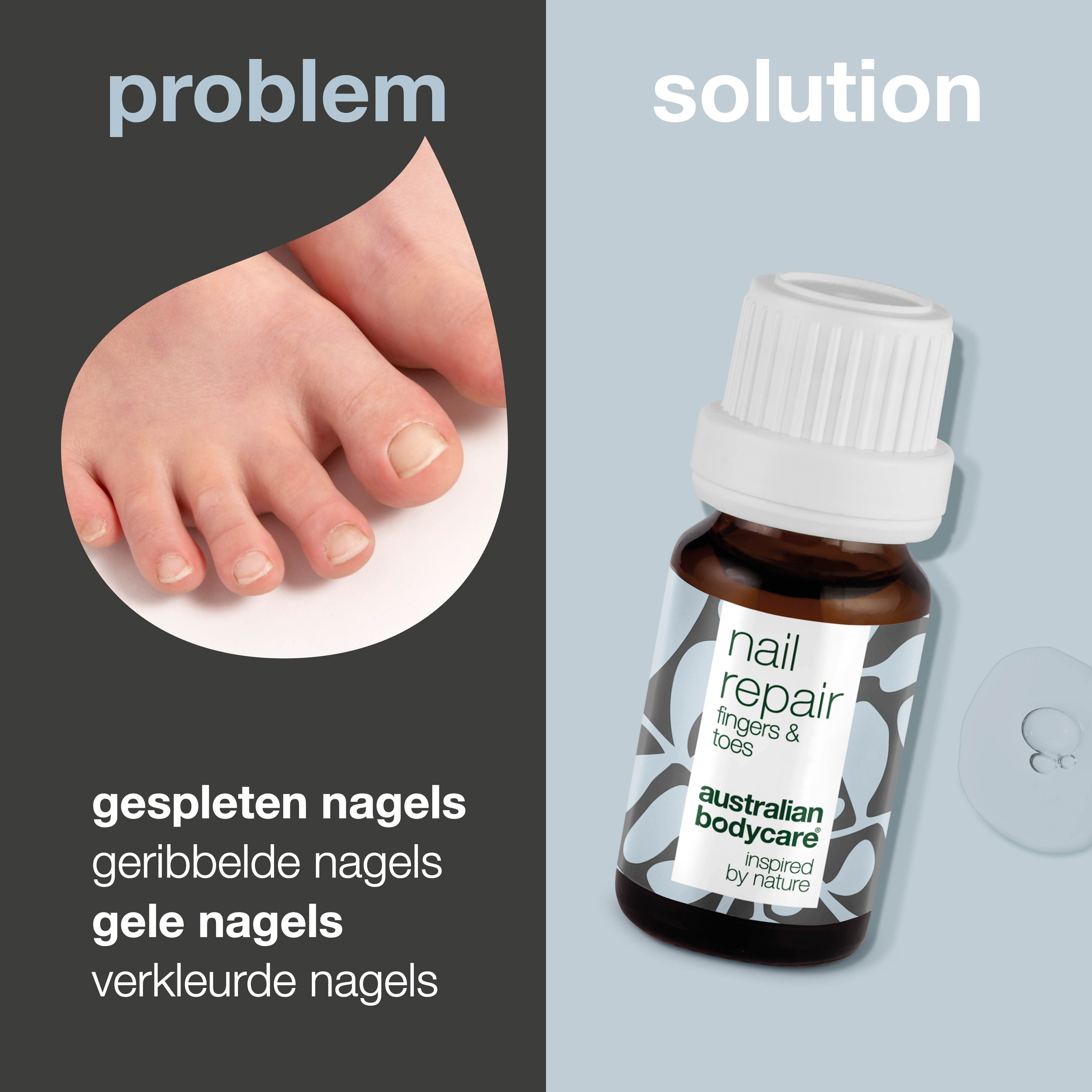 Nagelolie voor Nagelverzorging — Nagelverzorging voor verkleurde, gescheurde of ruwe nagels
