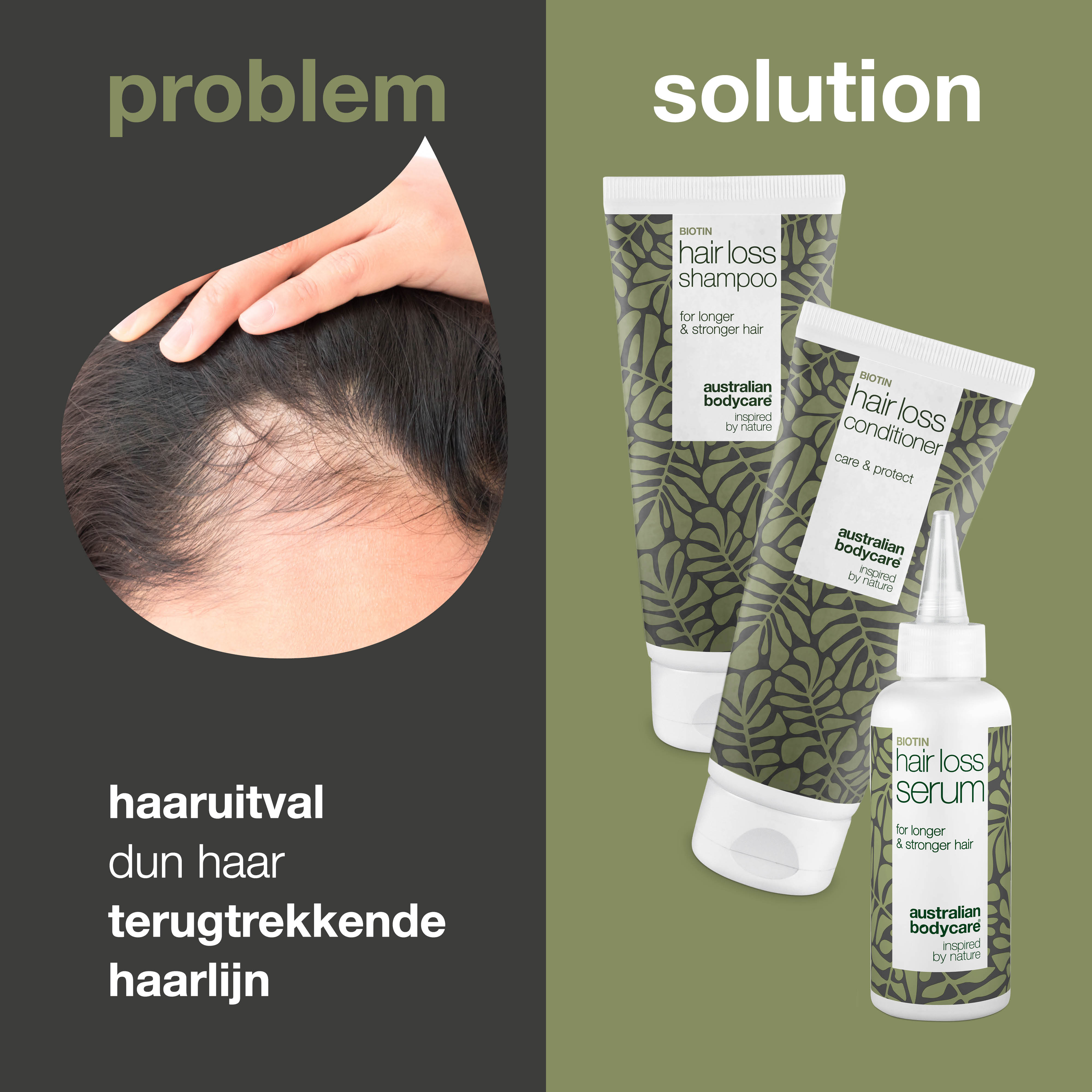 Complete Haaruitval Kit — 3 producten voor gezond, sterk en lang haar