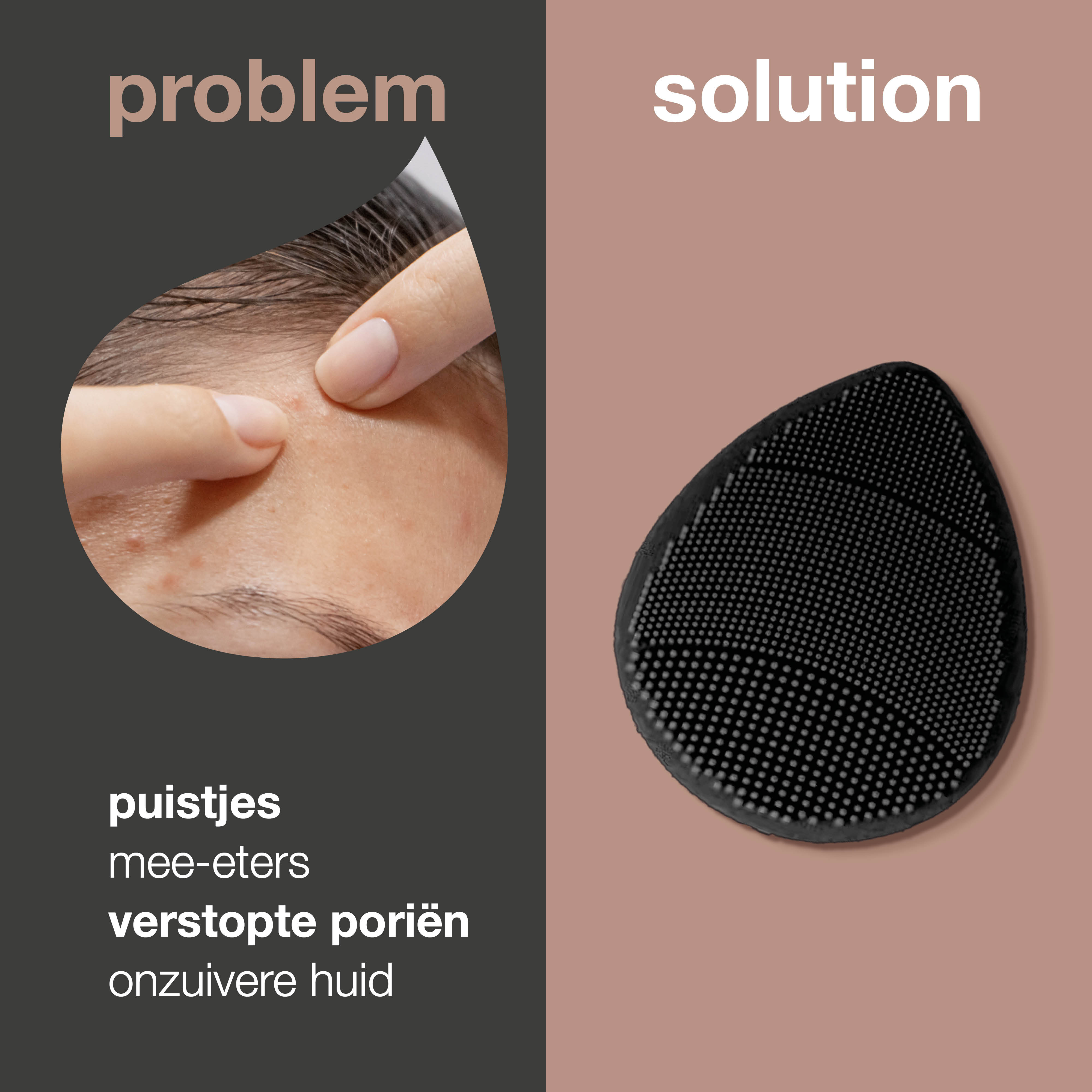 Anti-Puistjes Gezichtsborstel — Voor dagelijkse reiniging en peeling van onzuivere huid tegen puistjes en mee-eters.