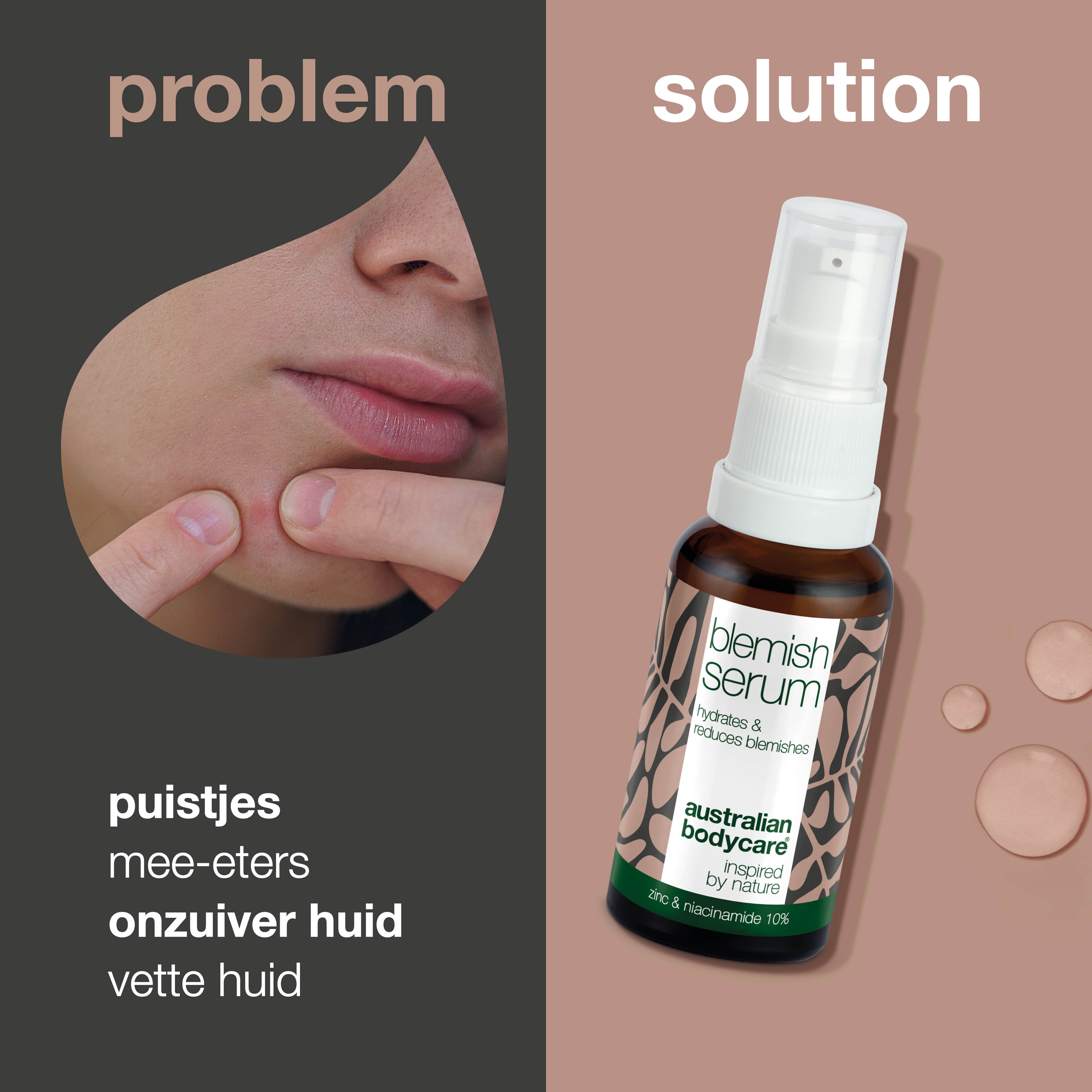 Anti-Puistjes Niacinamide Serum — 10% Niacinamide, 1% Zink en Tea Tree Olie tegen puistjes en onzuivere huid