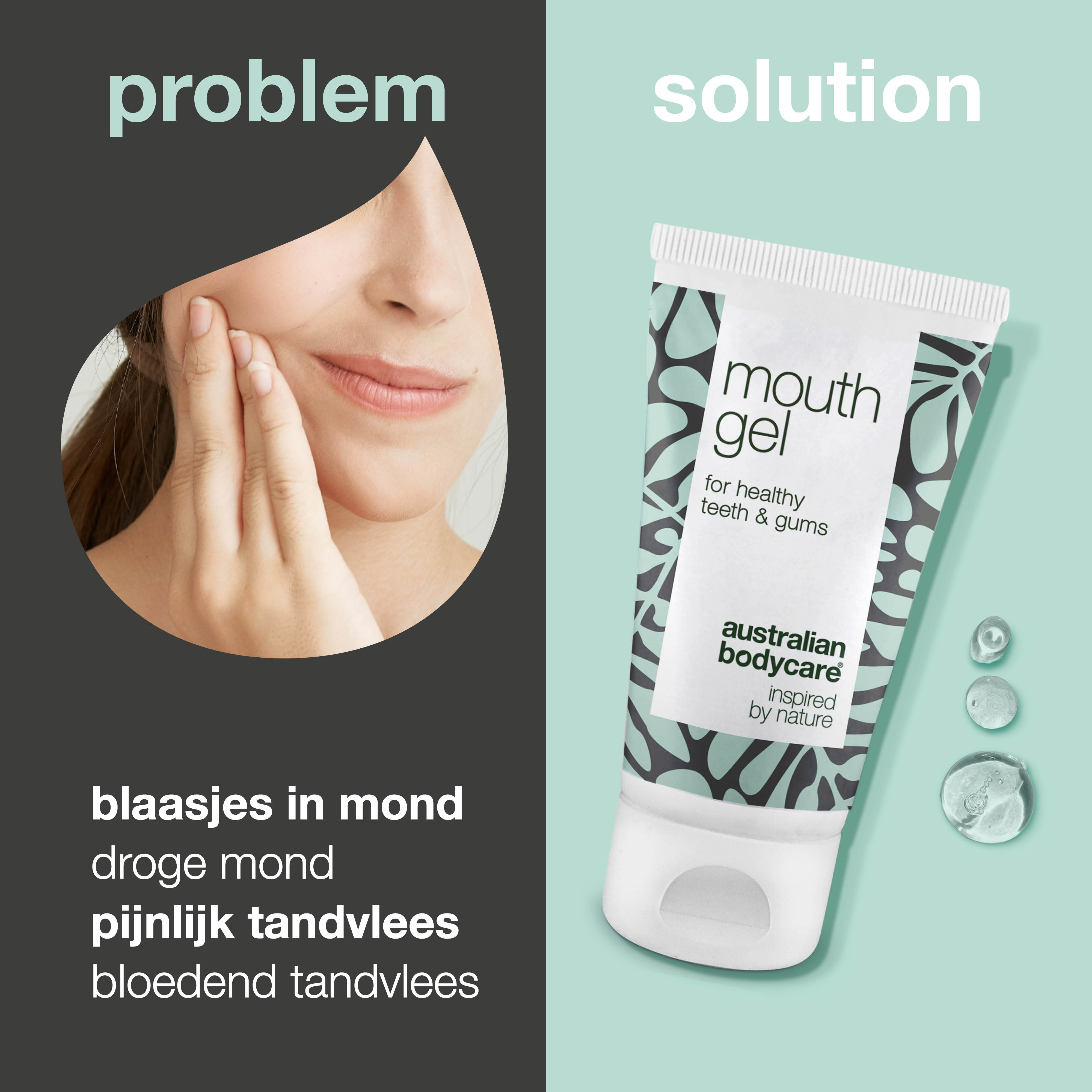 Mondgel voor mondverzorging — Gel voor dagelijkse verzorging van droge mond en tandvleesproblemen