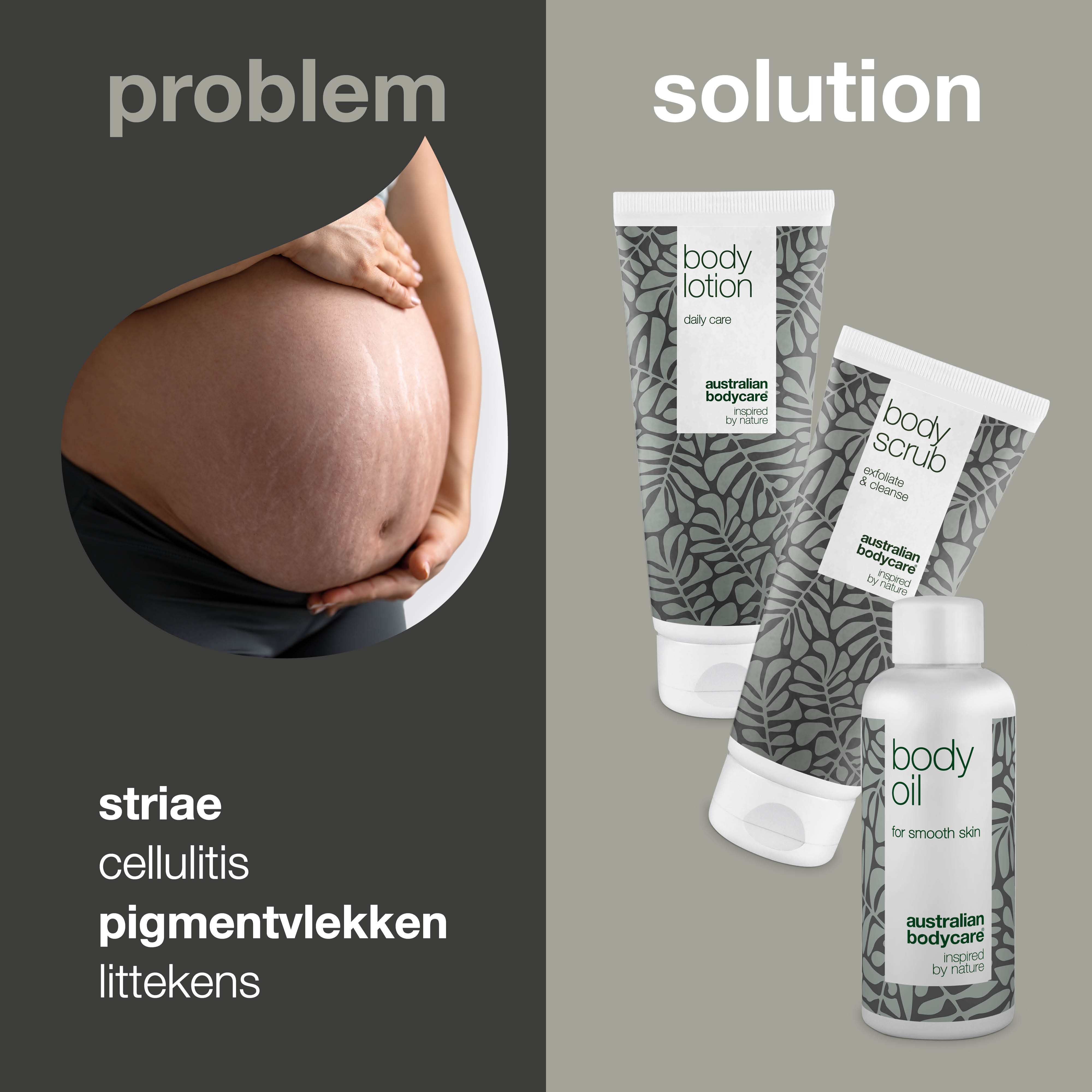 Een pakket met 3 producten voor striae — 3 producten om de zichtbaarheid van striae en littekens te verminderen