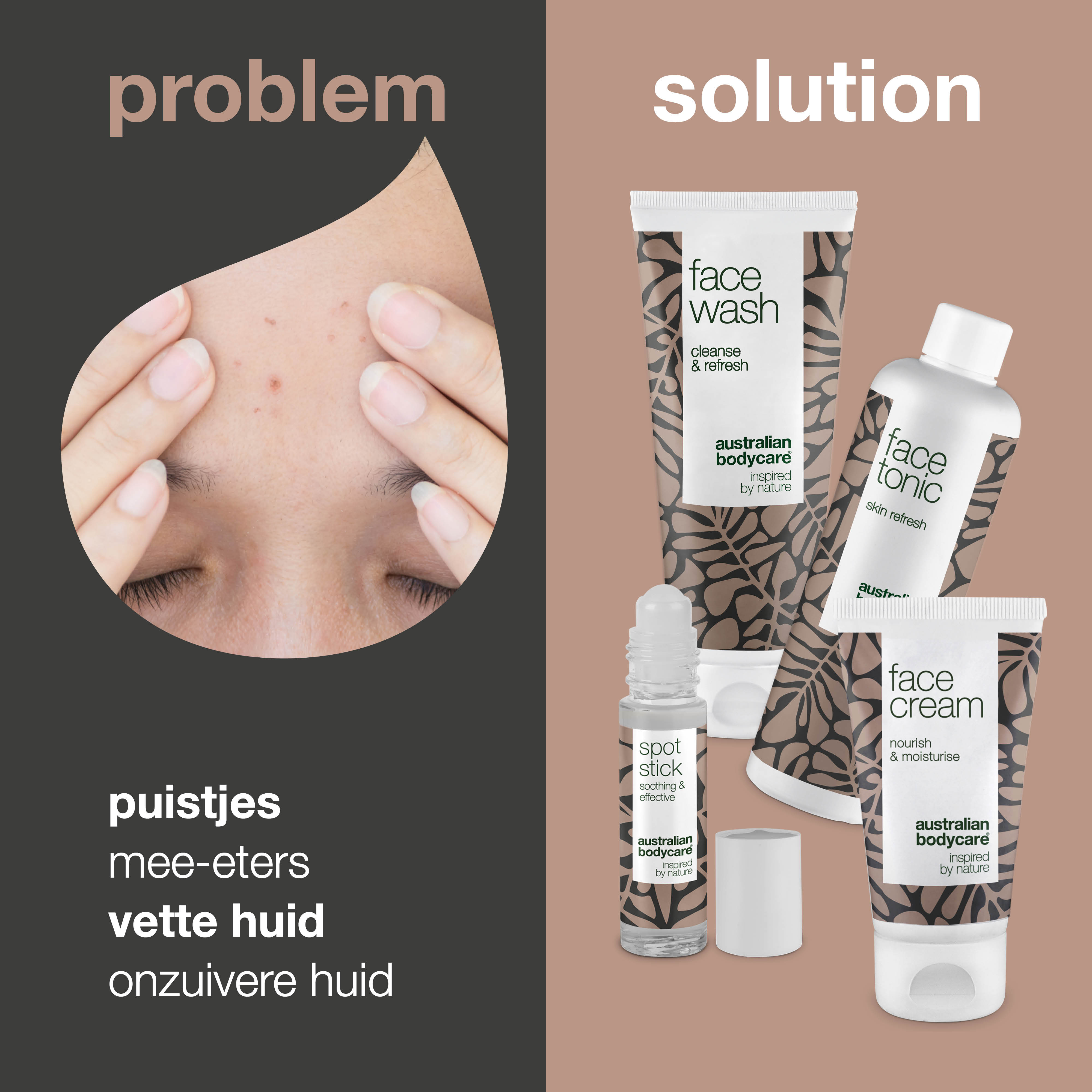 Pakket met 4 producten voor puistjes op voorhoofd — gezichtsverzorgingsproducten voor de verzorging van mee—eters en bultjes op voorhoofd