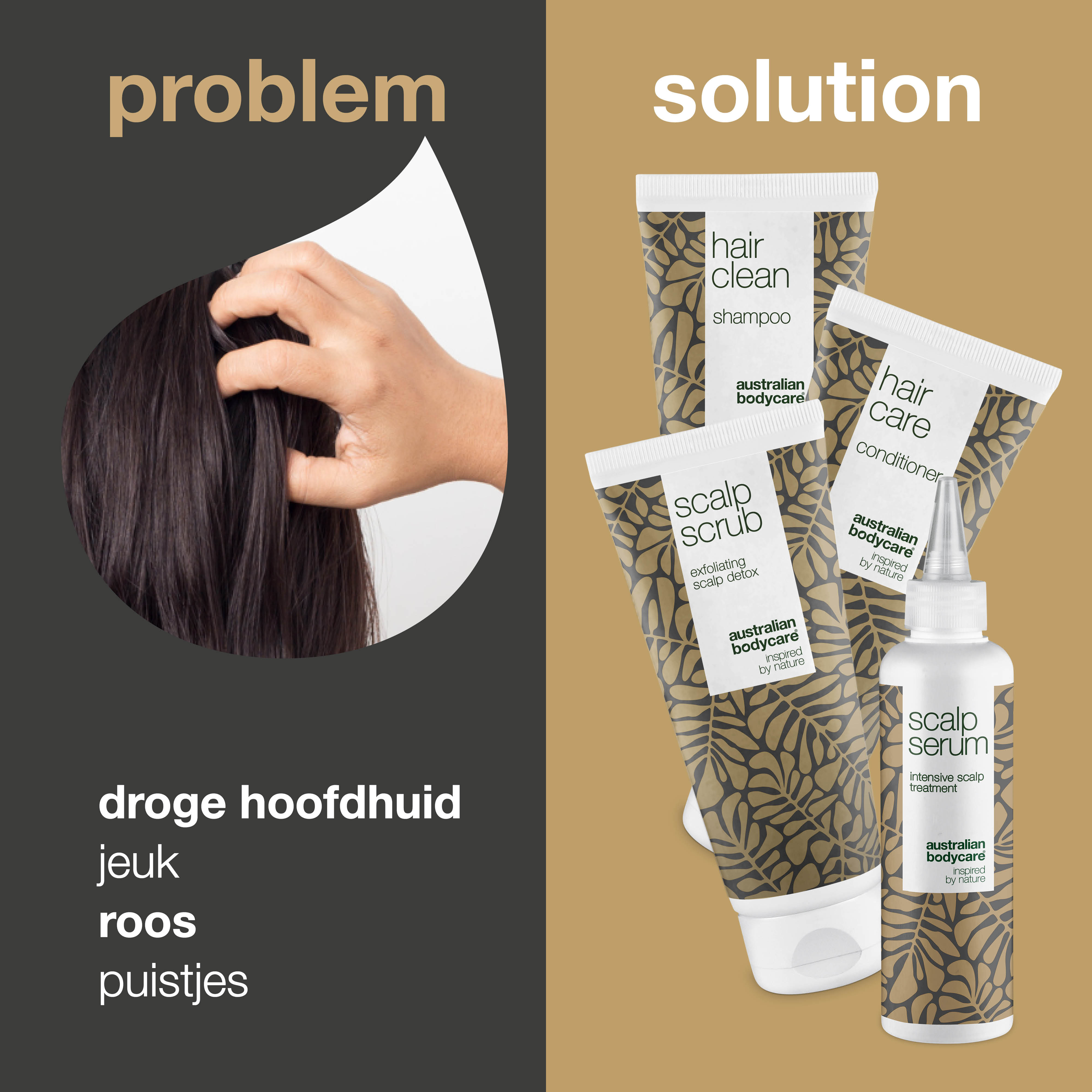 4 producten voor roos en droge hoofdhuid — Haarproducten voor roos, droge hoofdhuid, jeuk of vet haar