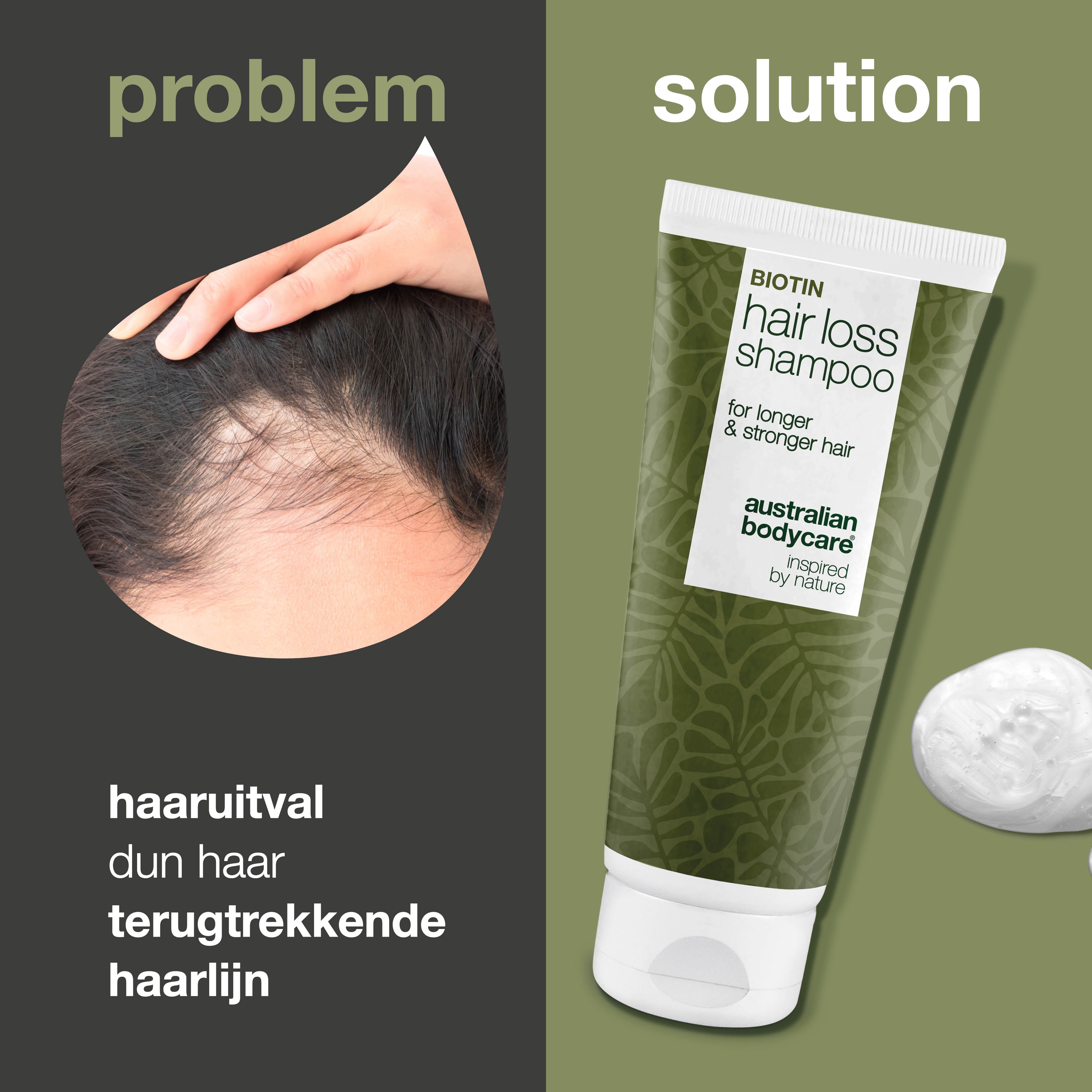 Shampoo vermindert haaruitval en dunner wordend haar — Shampoo vermindert haaruitval