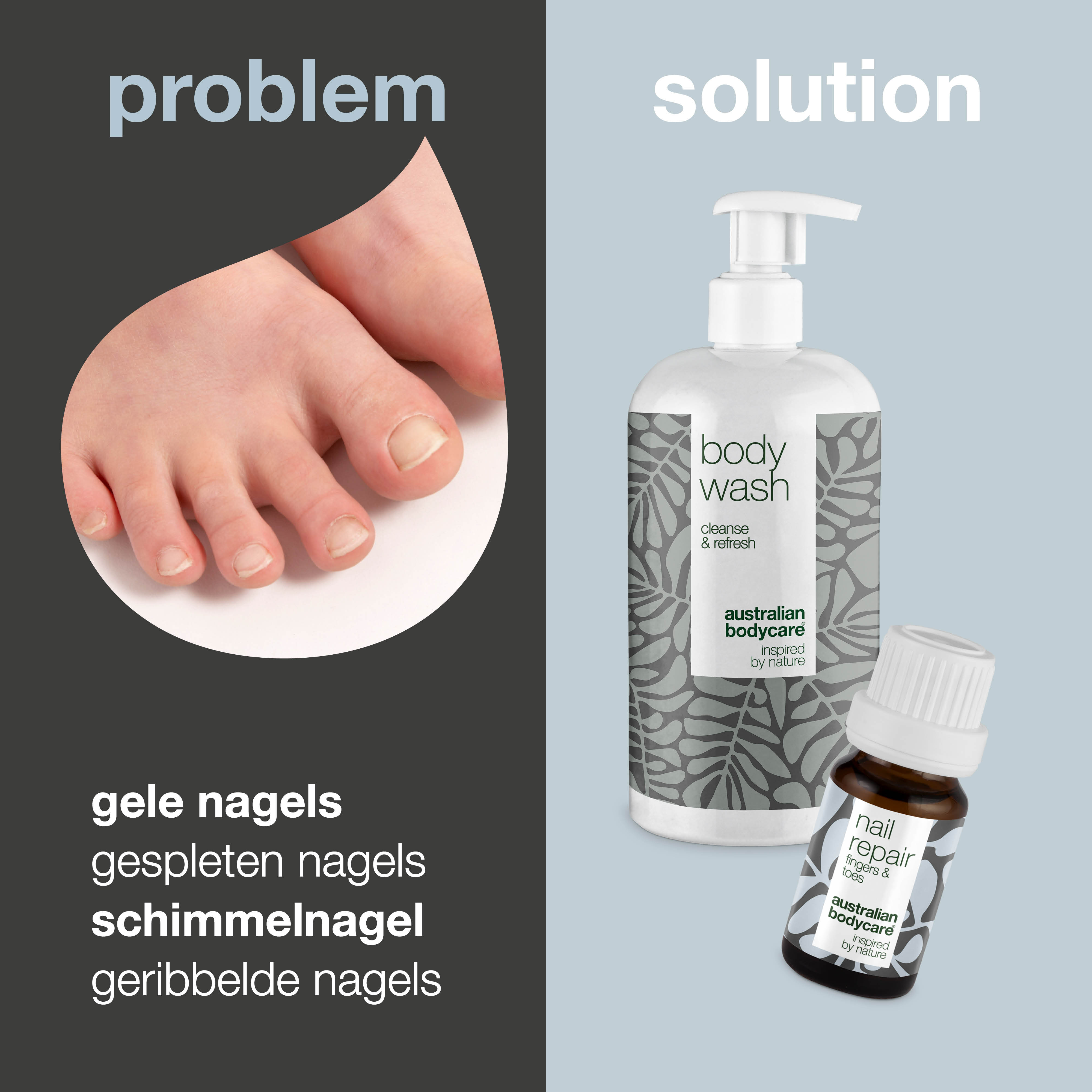 Nagelverzorging voor gele nagels — 2 producten voor de verzorging van kalknagel