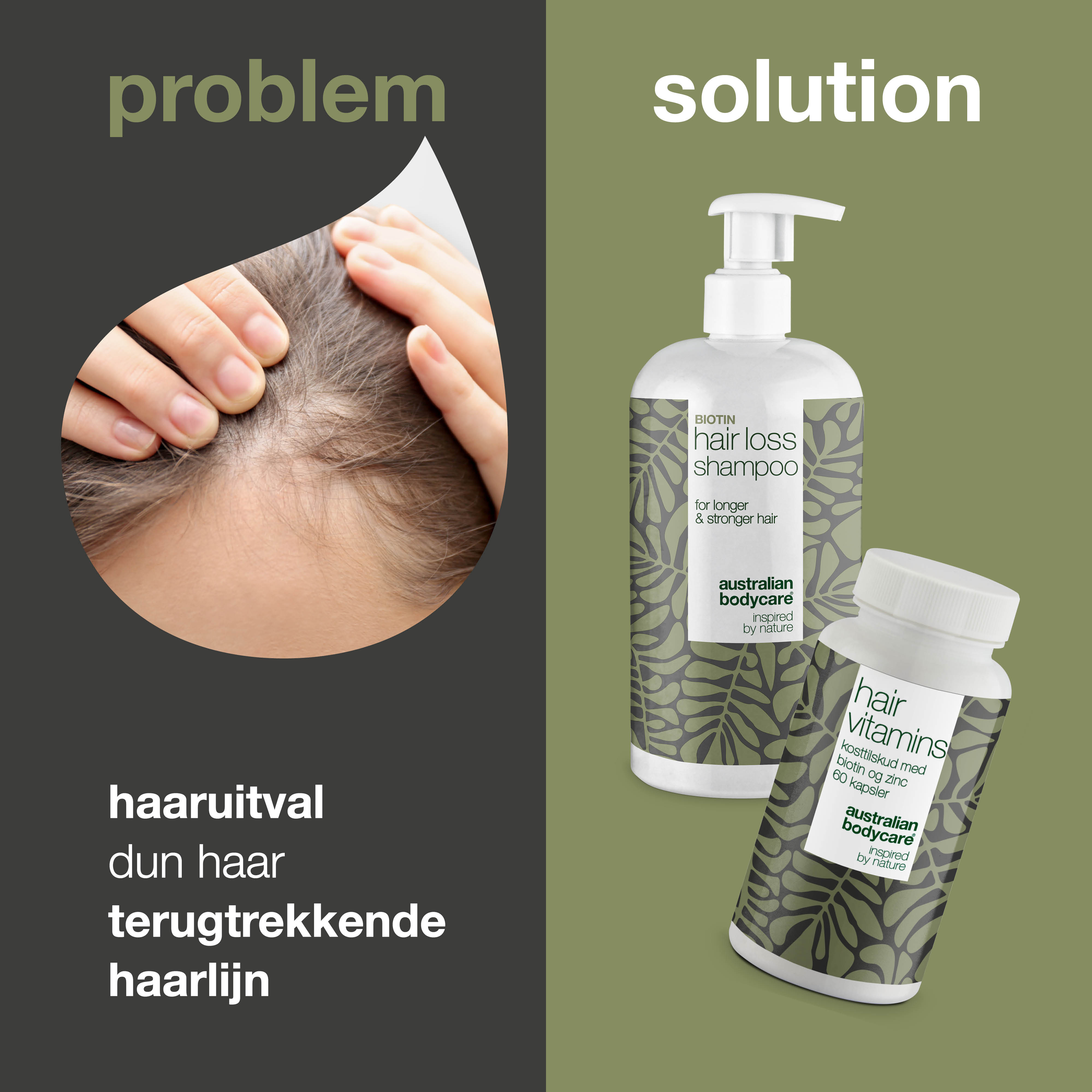 Shampoo en haaruitval vitamines voor dun en fijn haar — Producten voor de verzorging van dun en fijn haar