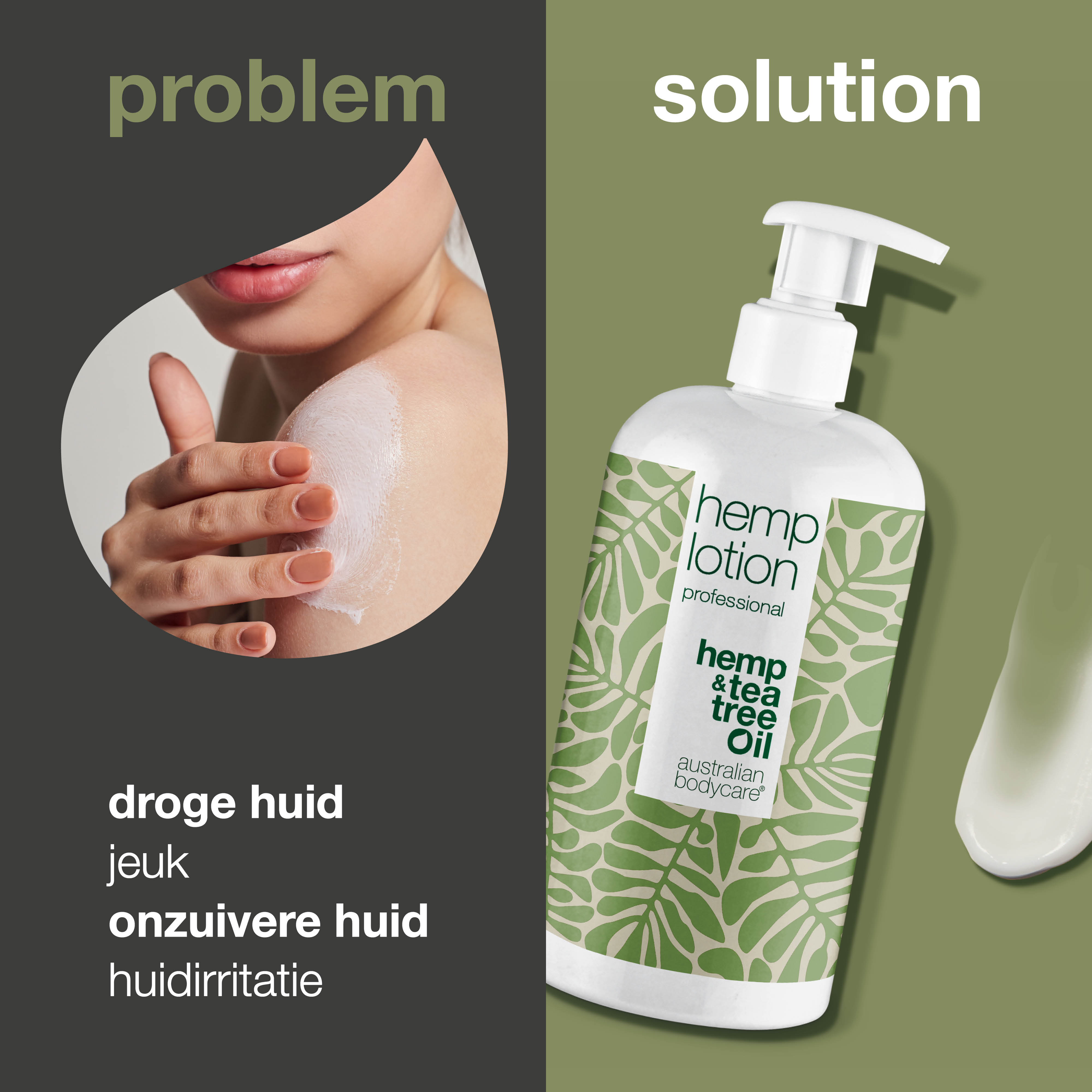 Hennep Bodylotion — Hydraterende verzorging voor droge huid en puistjes op het lichaam