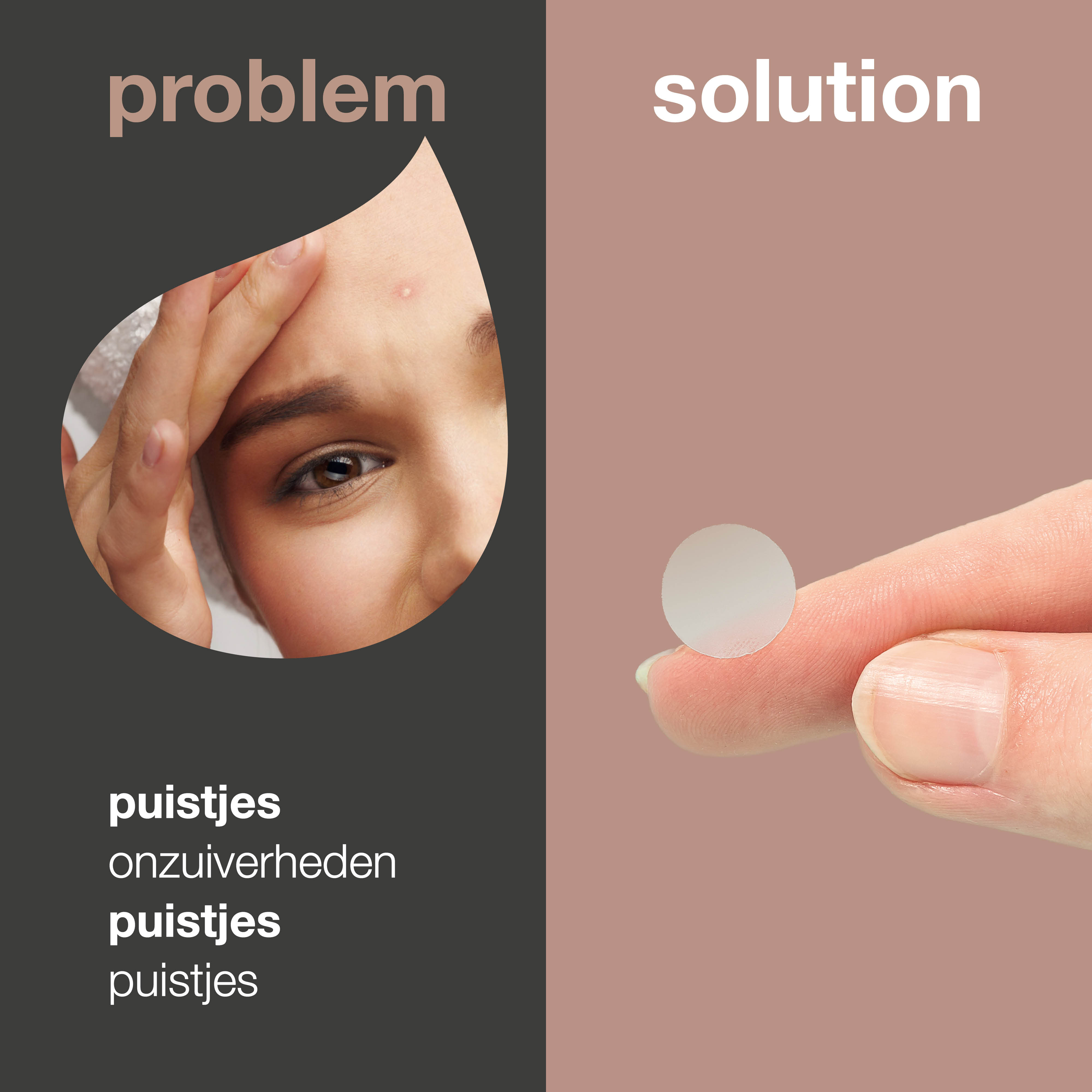 Pimple Patches tegen puistjes — Effectieve oplossingen voor een zuivere huid met Hyaluronzuur & Salicylzuur