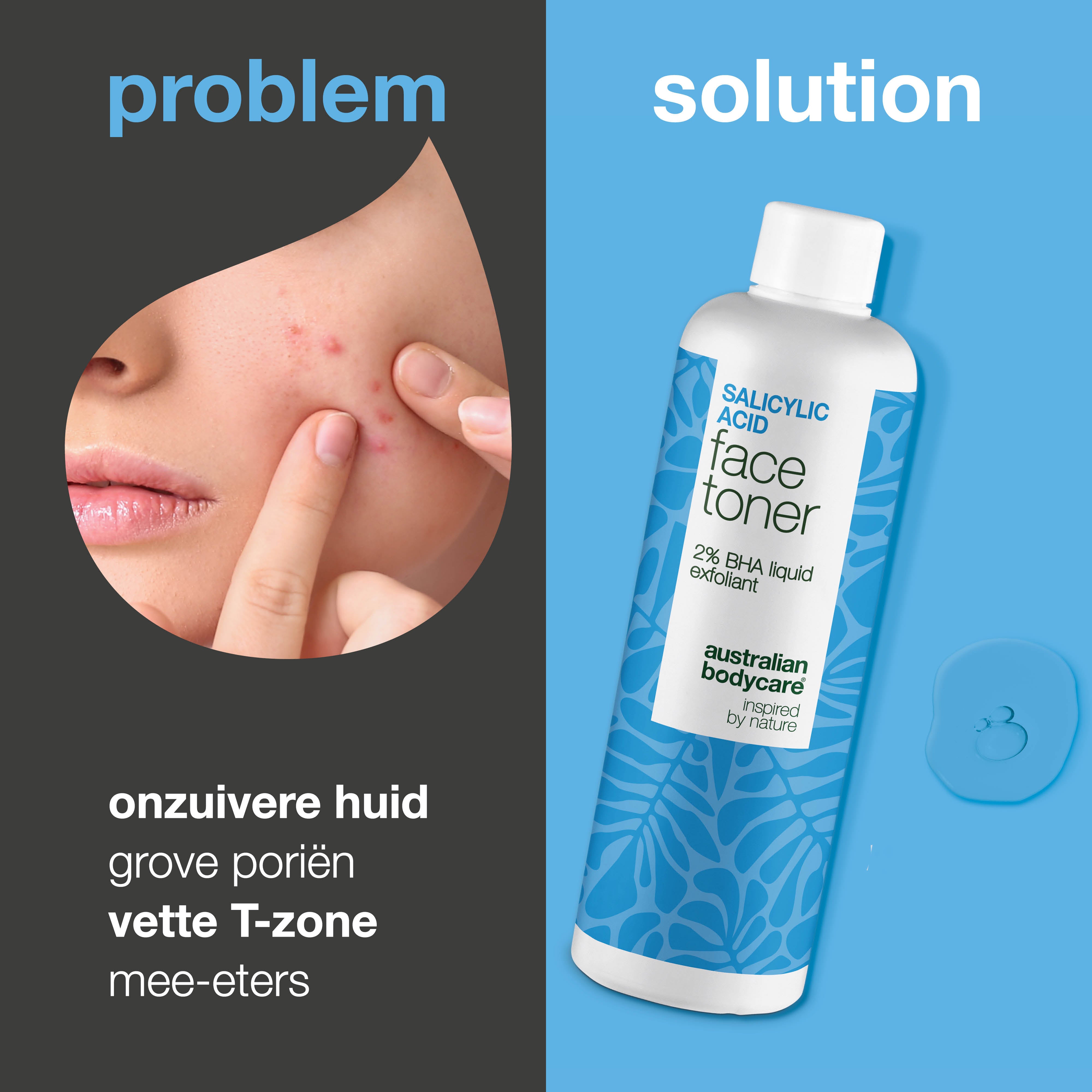 Salicylic Acid toner zuivert de huid, vermindert mee-eters en grove poriën. Perfect voor een onzuivere huid. Bevat Salicylic Acid van Australian Bodycare.