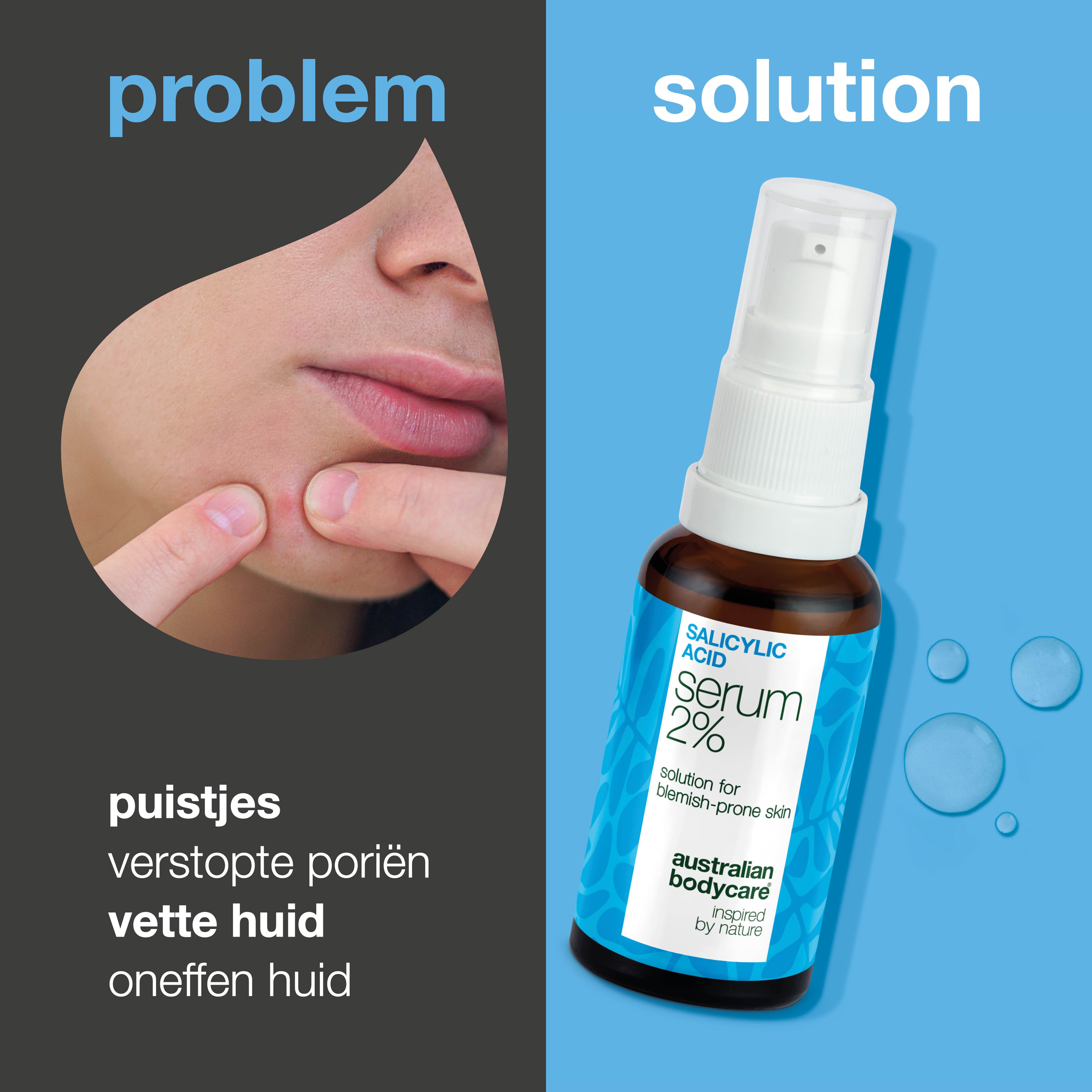 Salicylzuur 2% serum voor verstopte poriën, acnegevoelige huid en uitbraken. Bevat Zinc PCA, groene thee-extract, hyaluronzuur en glycerine.