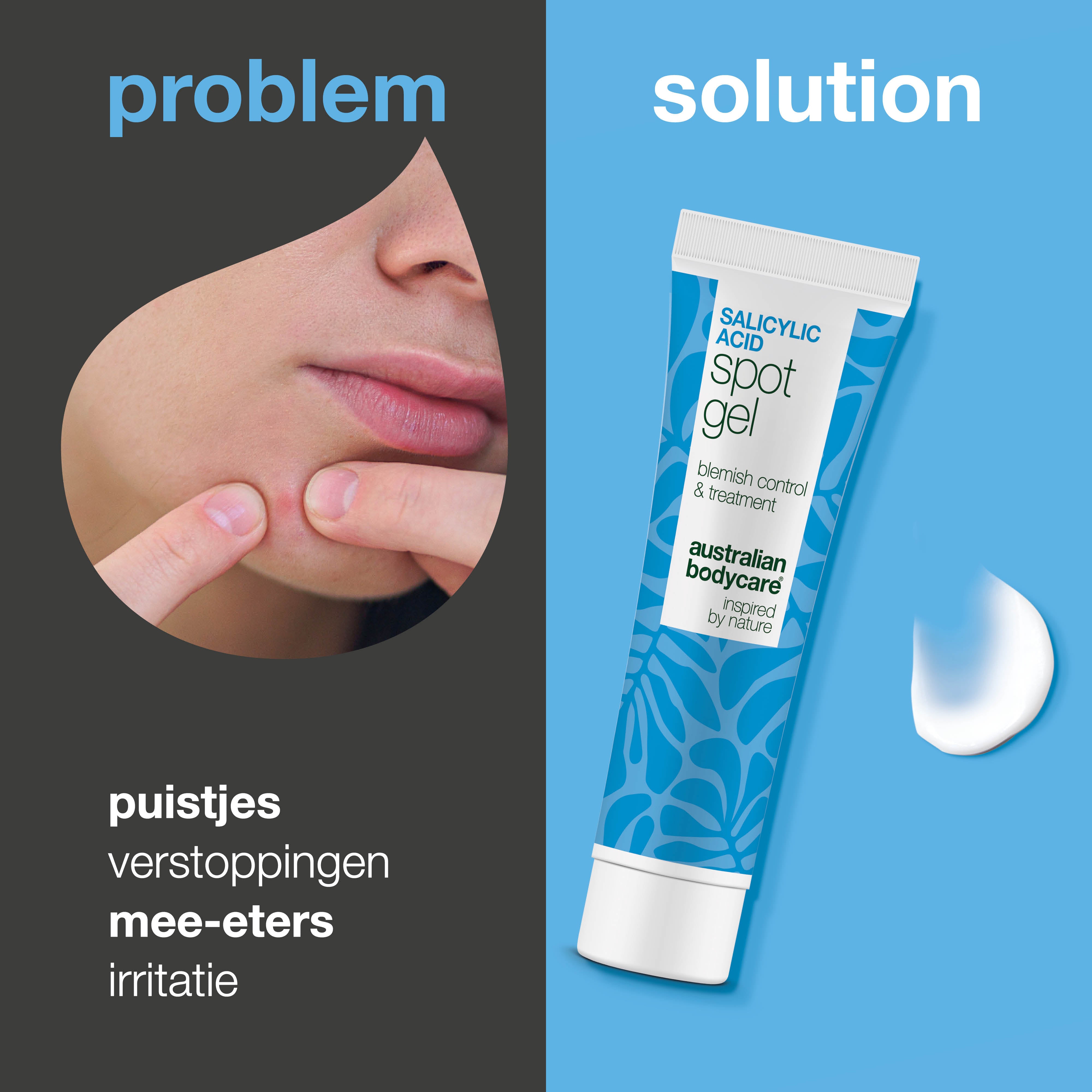 Salicylzuur Spot Gel tegen puistjes, mee-eters en roodheid – reinigt poriën en kalmeert de huid