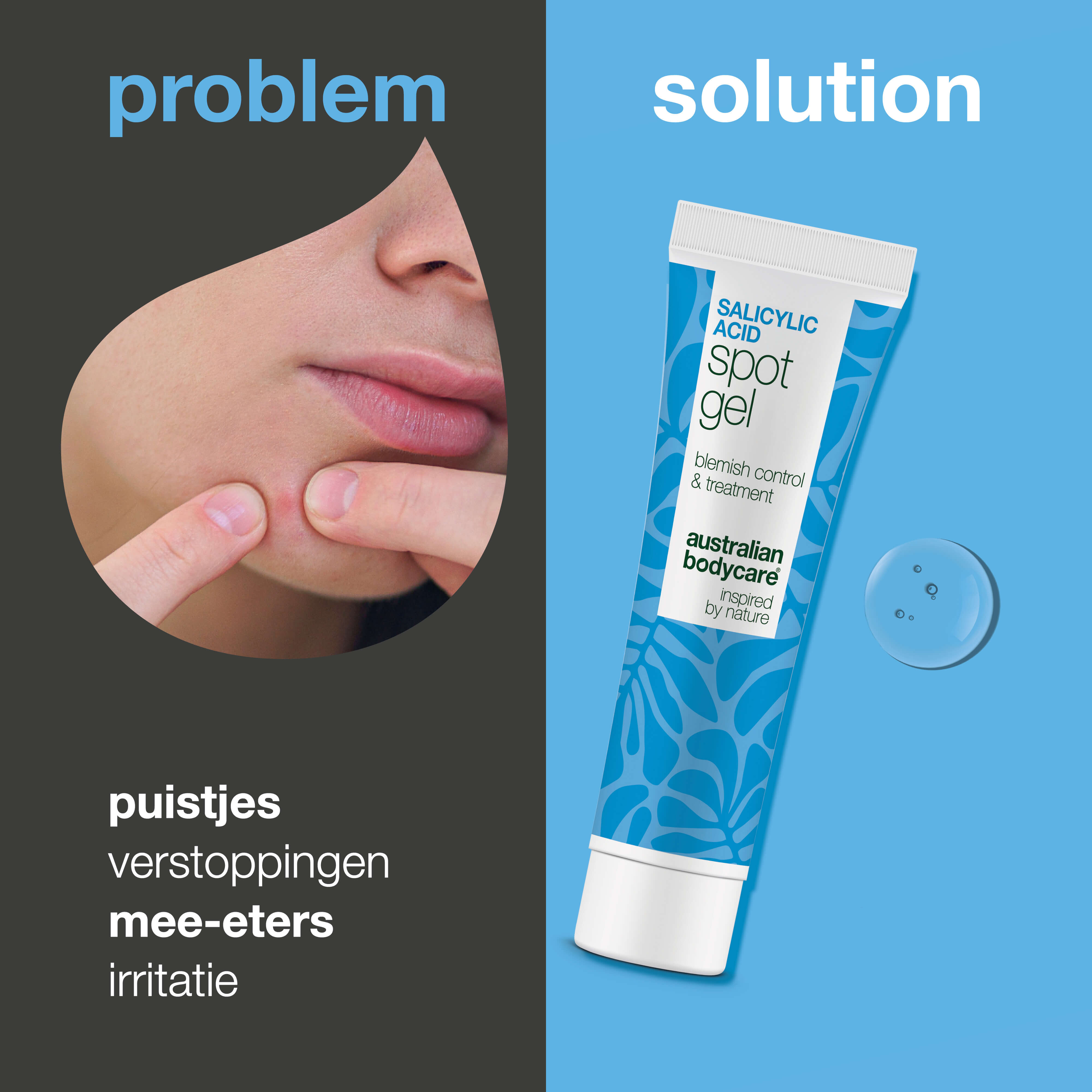 Salicylzuur Spot Gel tegen puistjes en verstopte poriën — Salicylzuur Spot Gel zuivert en balanceert de huid. Verwijdert overtollig talg en dode huidcellen met salicylzuur.