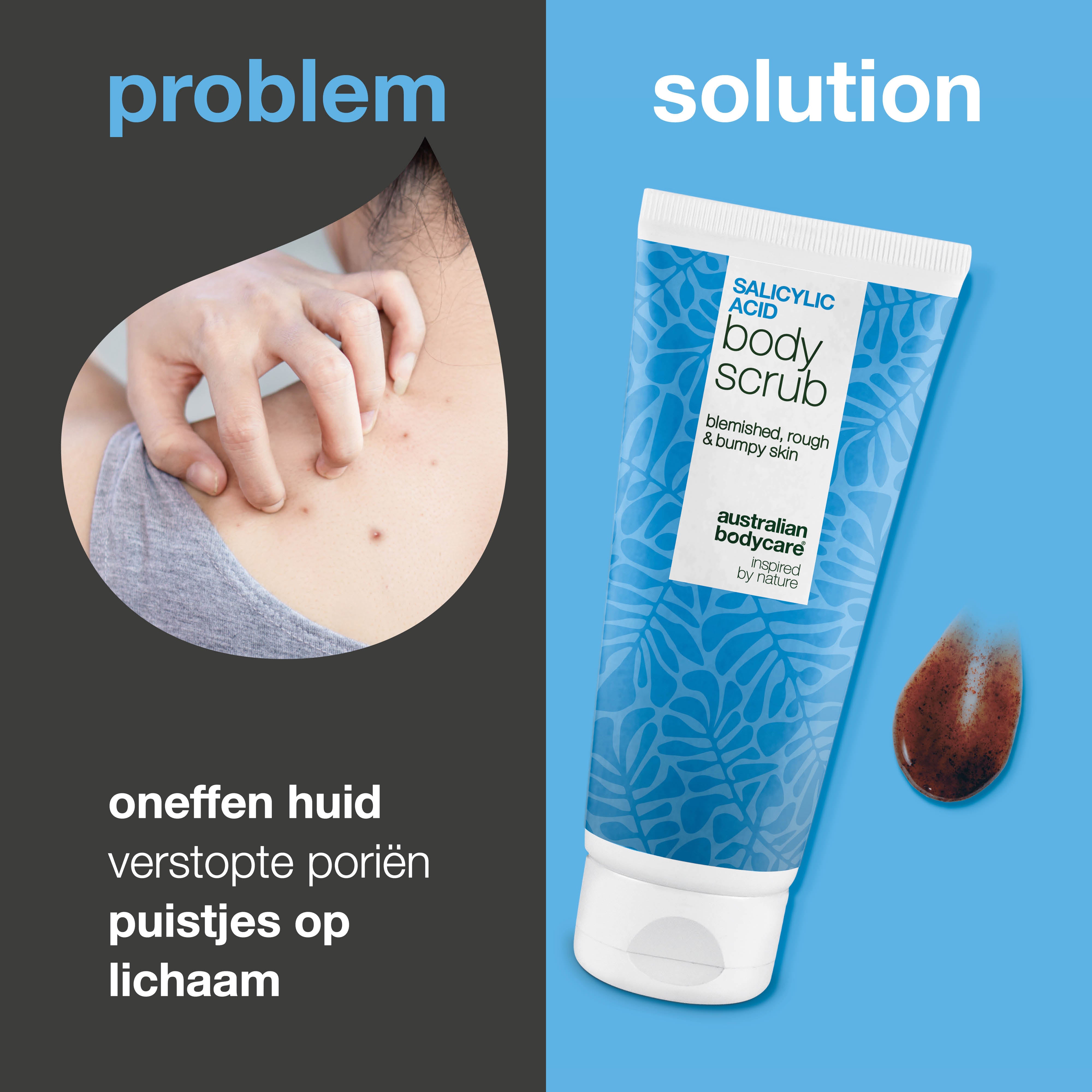 Body Scrub met salicylzuur voor een zuivere en gladdere huid — Body Scrub met salicylzuur verwijdert puistjes en onzuiverheden. Bevat salicylzuur, glycolzuur, abrikozenpitpoeder en allantoïne.