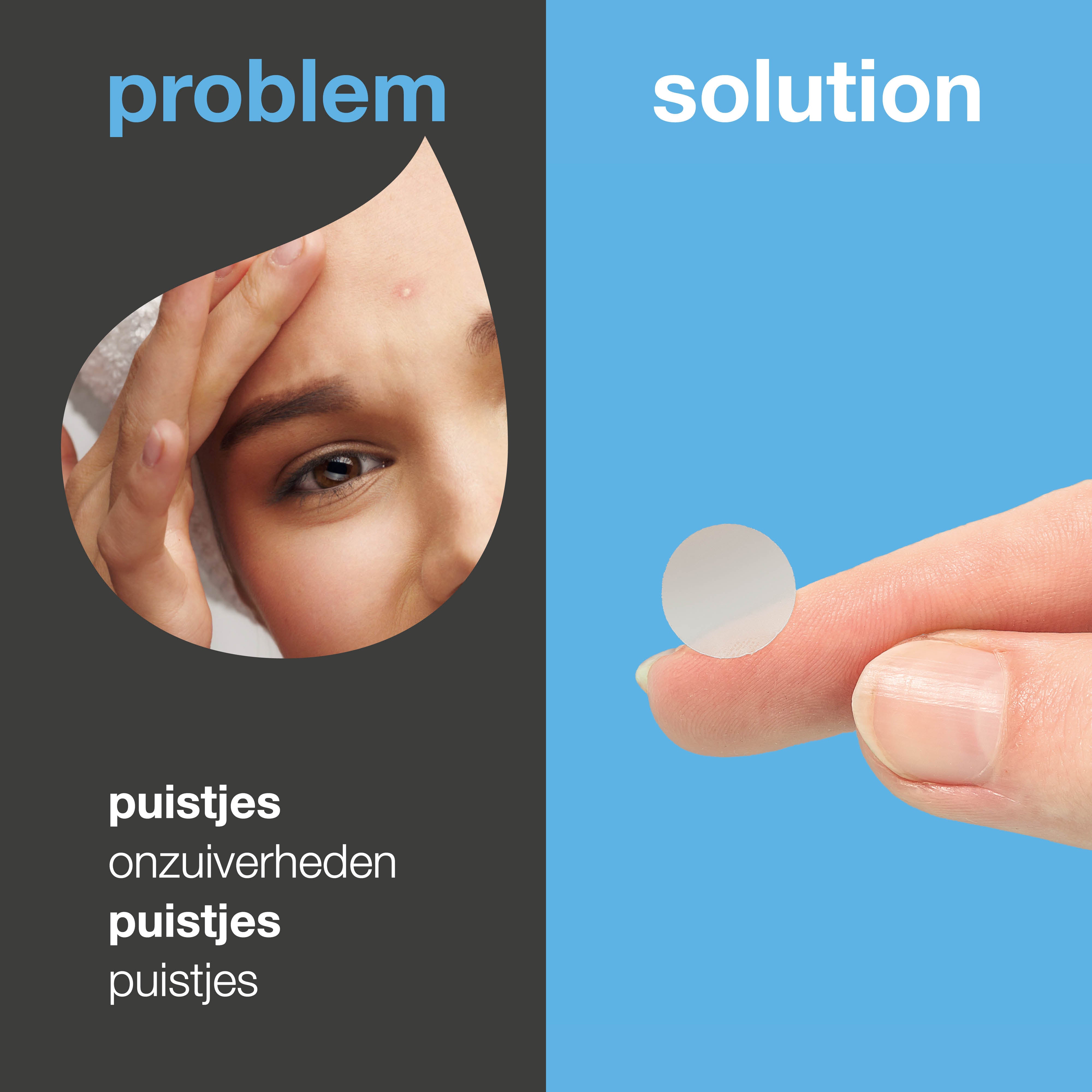 Salicylzuur Pimple Patches helpen bij roodheid, onzuiverheden en huidirritatie. Met salicylzuur, groene thee-extract en hyaluronzuur.
