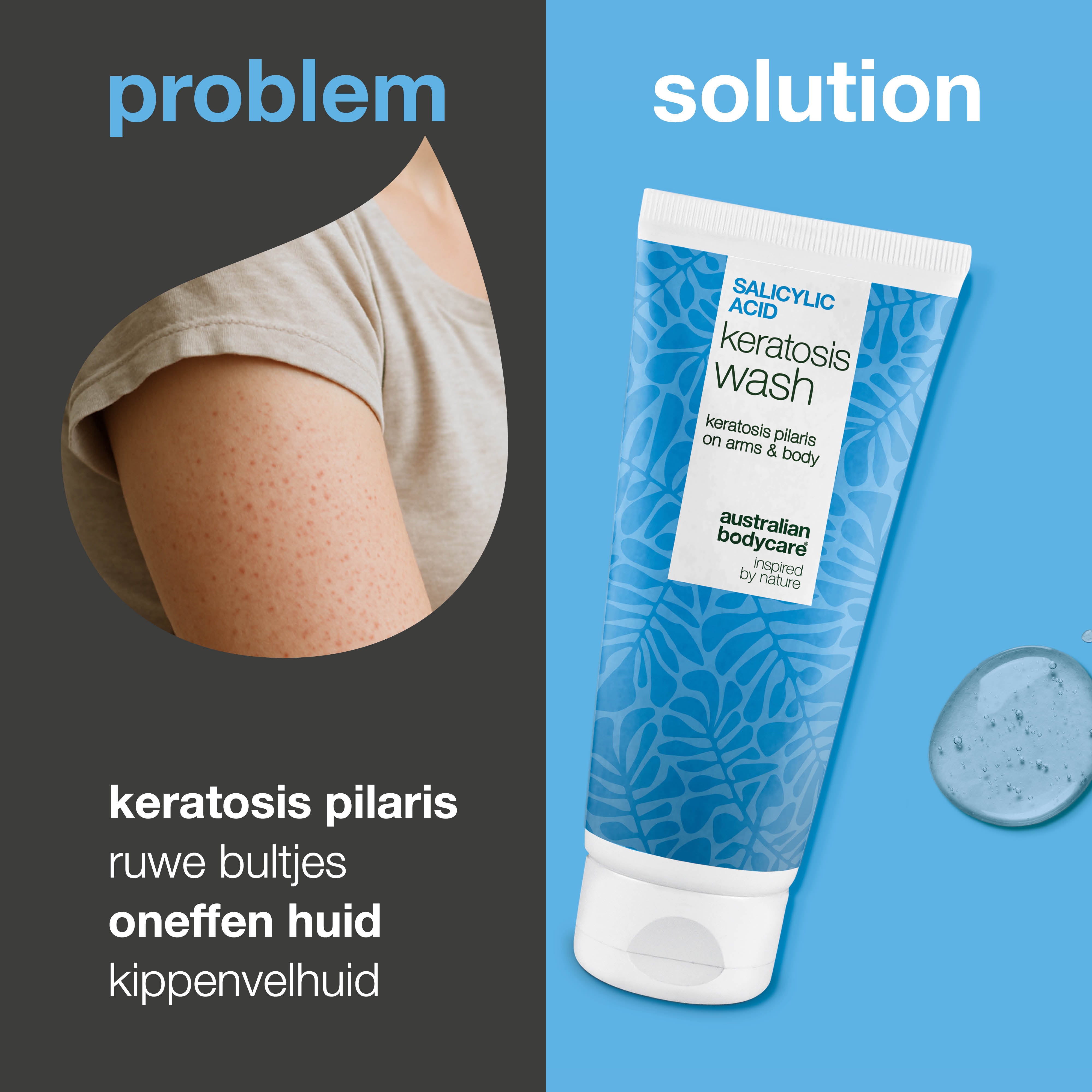 Keratosis Pilaris Body Wash voor keratosis pilaris, droge huid en verstopte poriën. Bevat salicylzuur, niacinamide, zink PCA en vitamine E voor zichtbaar resultaat.
