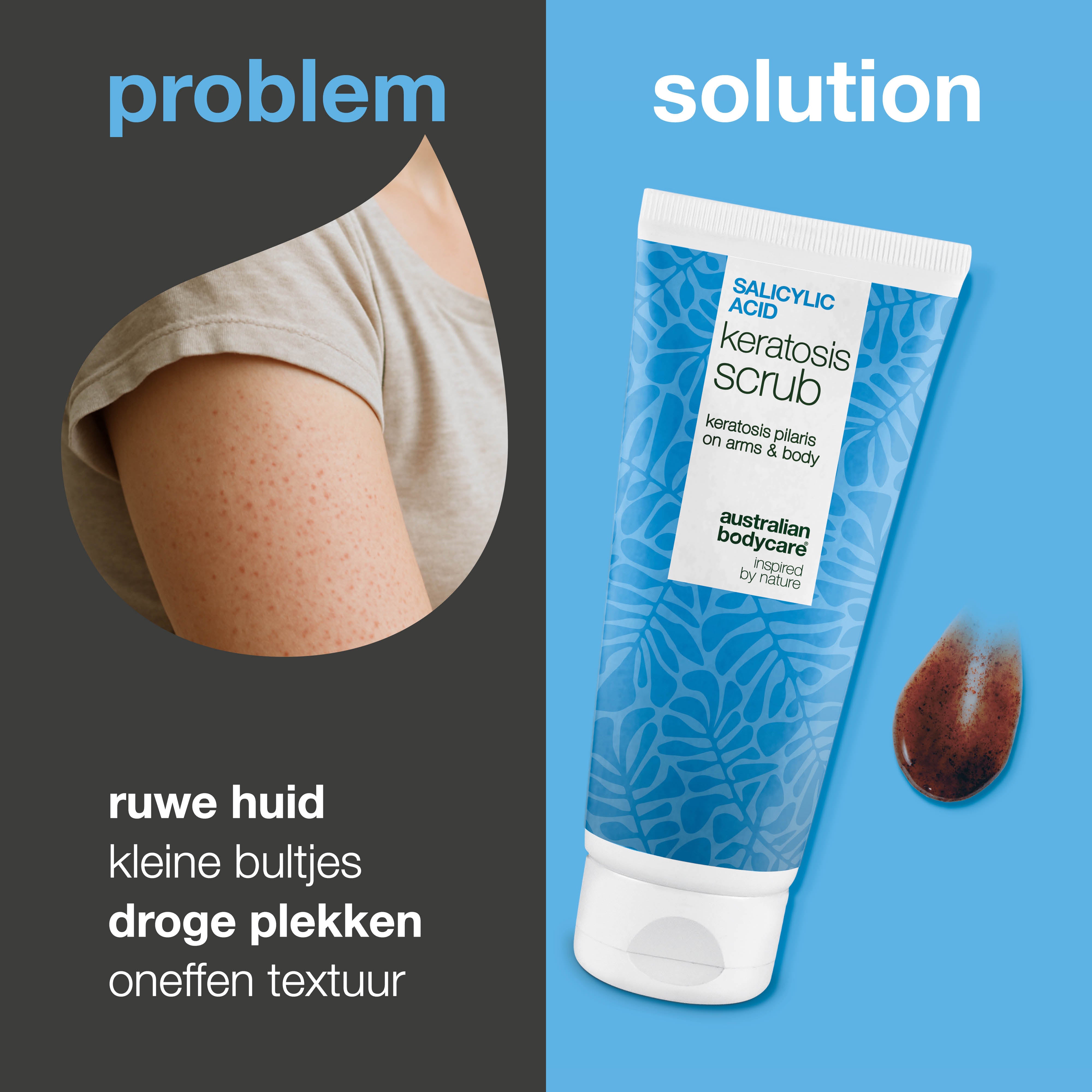 Keratosis Pilaris Body Scrub verwijdert dode huidcellen en vermindert bultjes. Maakt de huid glad met salicylzuur, glycolzuur en allantoïne.