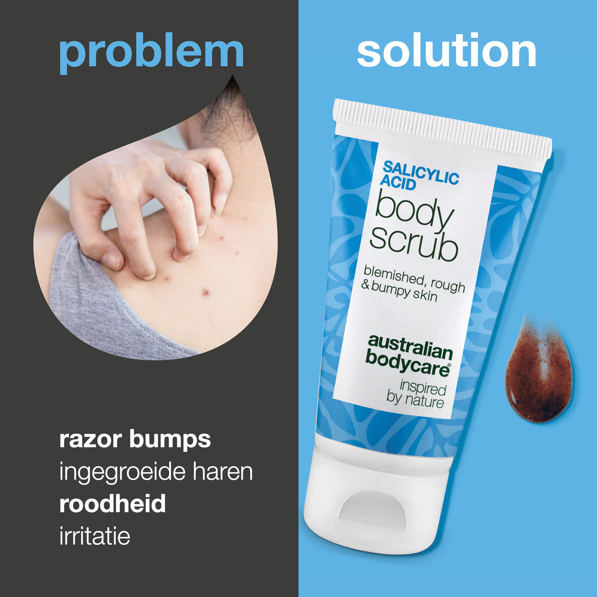 Probleem en oplossing: puistjes op het lichaam, verstopte poriën en een ongelijkmatige huid. Links een close-up van een schouder met puistjes, rechts de Salicylic Acid Body Scrub van Australian Bodycare