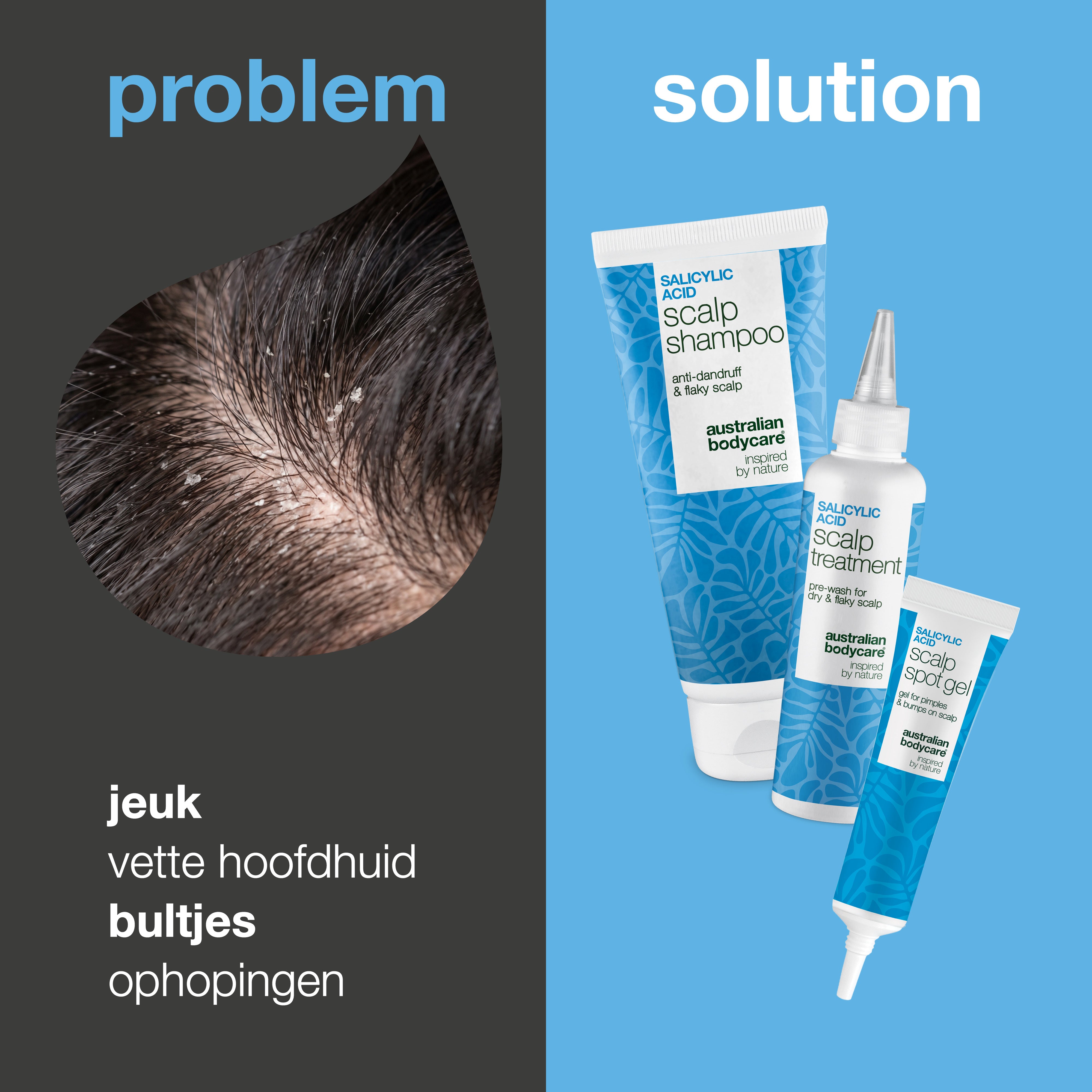 Probleem en oplossing: close-up van jeuk, vet haar en ophoping op de hoofdhuid naast de drie producten uit de set