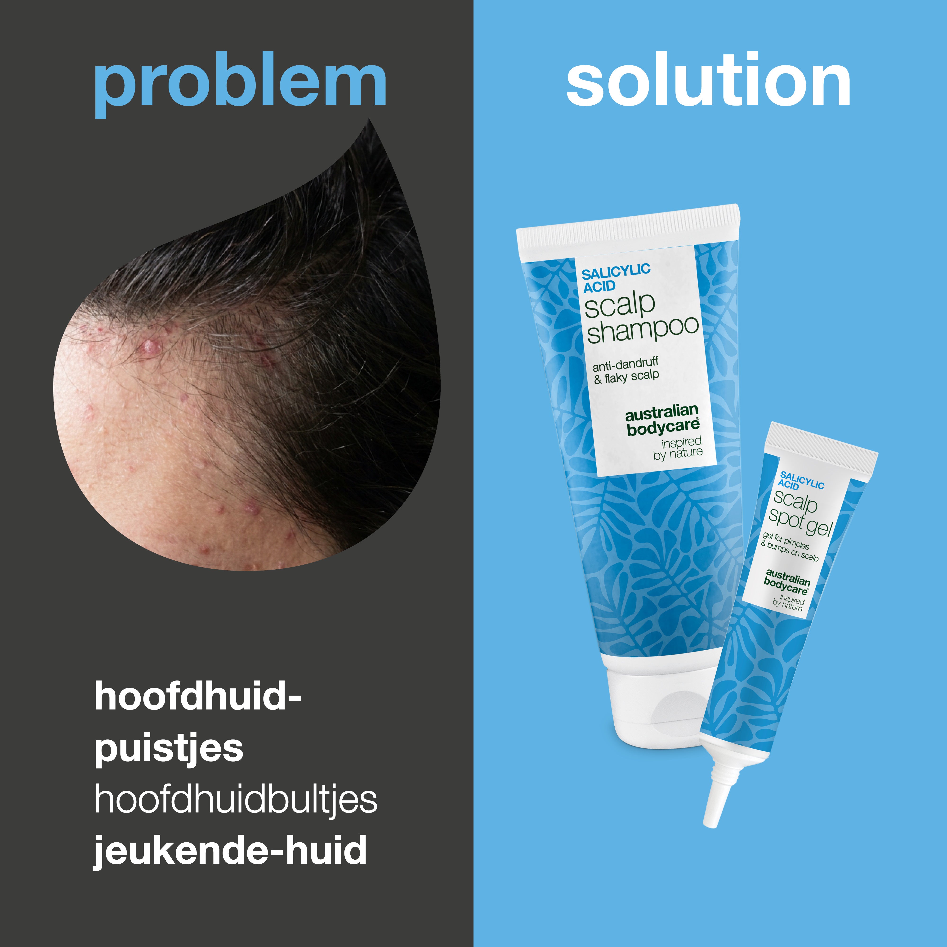 Probleem en oplossing: close-up van puistjes en bultjes op de hoofdhuid naast de shampoo en spot gel uit de set