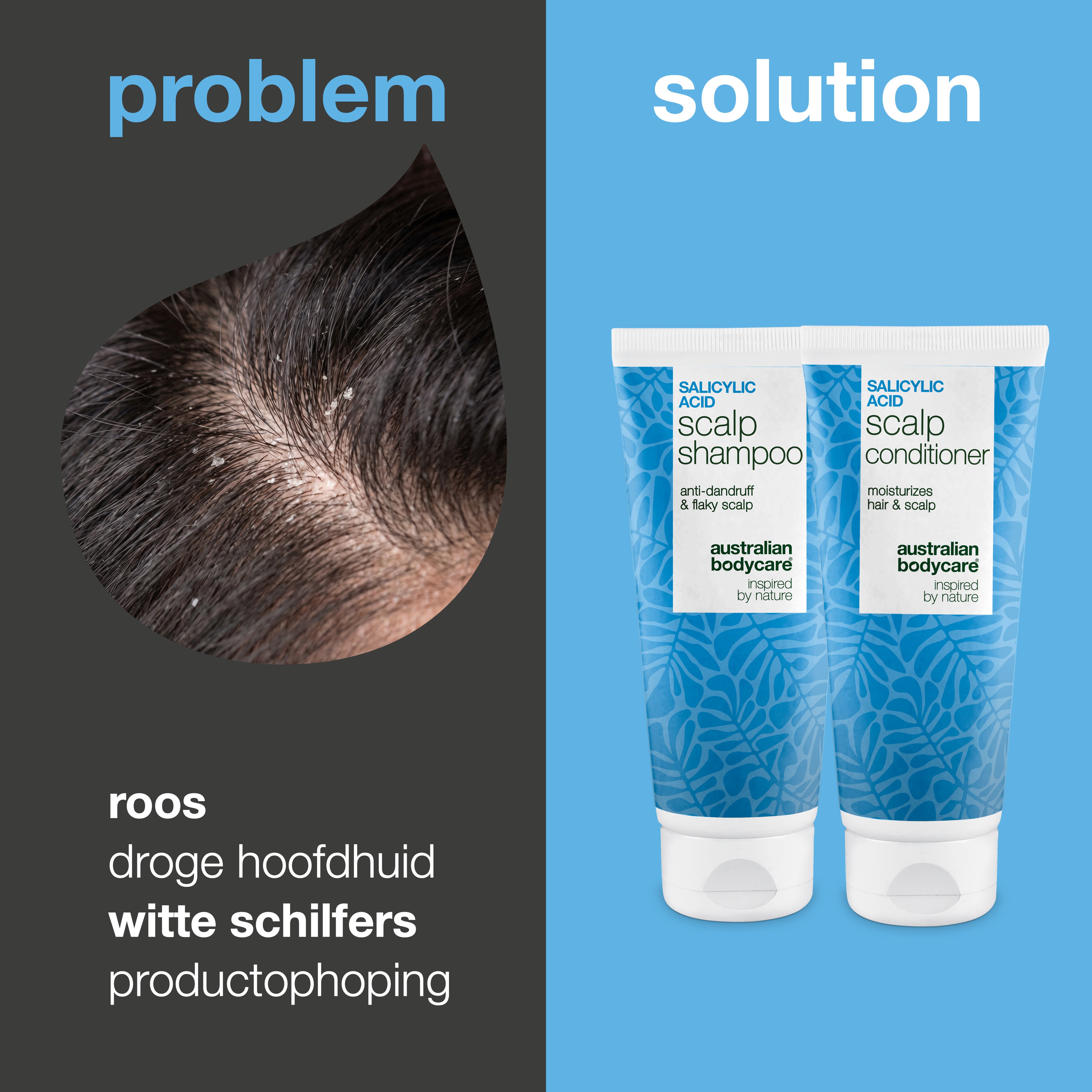Probleem en oplossing: close-up van roos en witte schilfers op de hoofdhuid naast de shampoo en conditioner uit de set