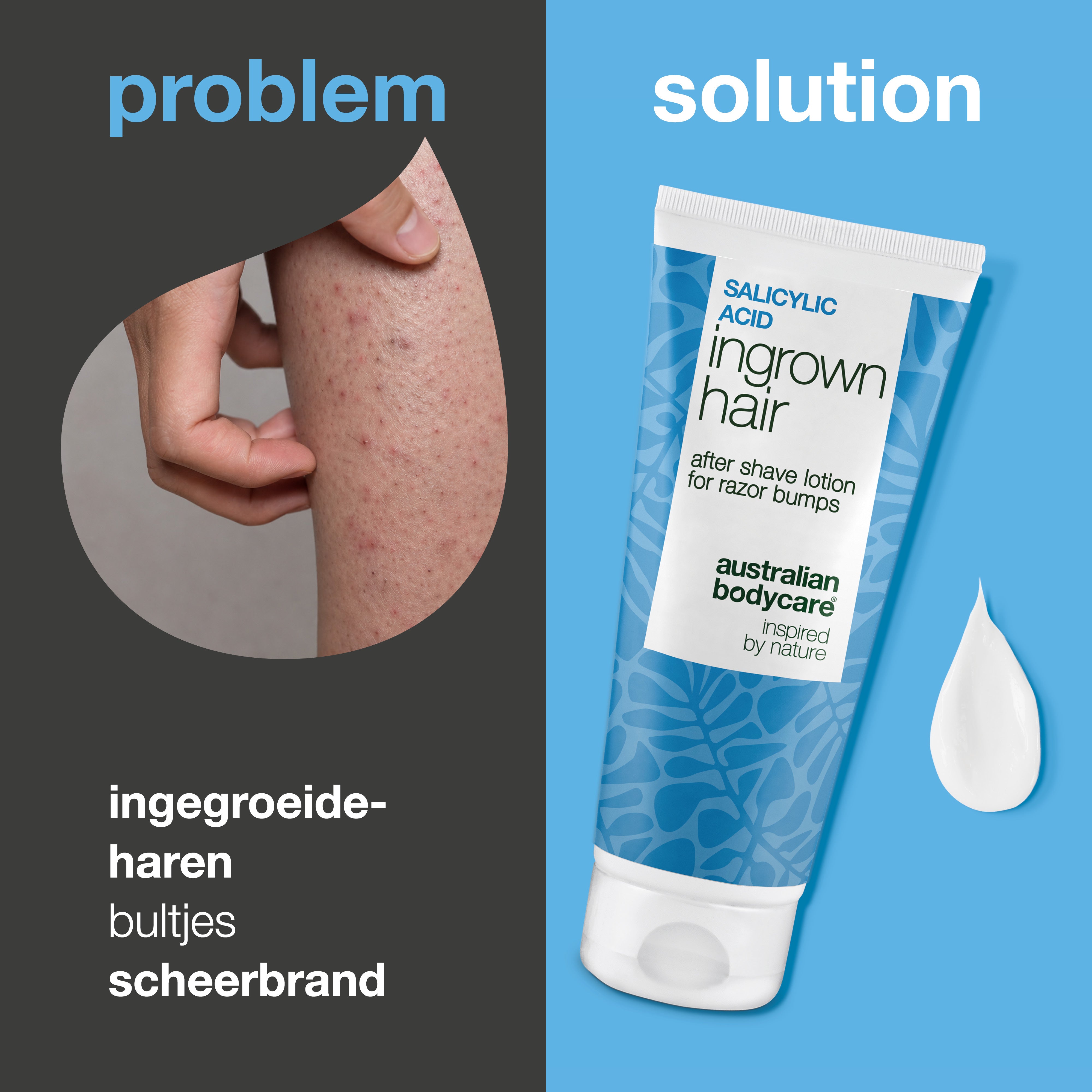 Salicylzuur After Shave Lotion tegen ingegroeide haren, rode bultjes en irritatie na het scheren. Het product wordt getoond naast huid met zichtbare rode bultjes en ingegroeide haren.