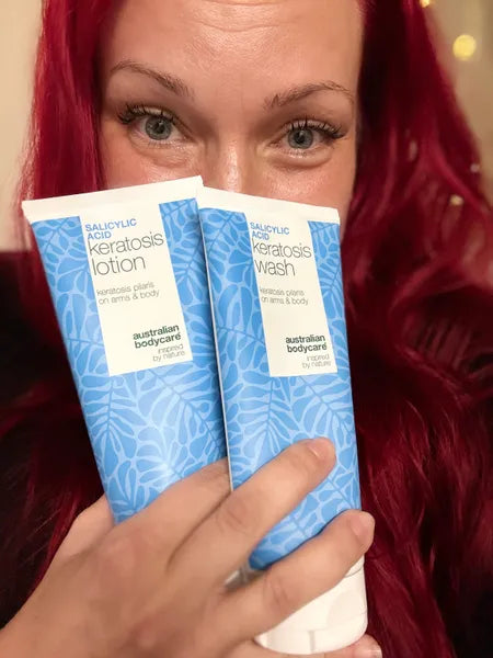 Klantresultaat keratosis pilaris – Viktorija K.