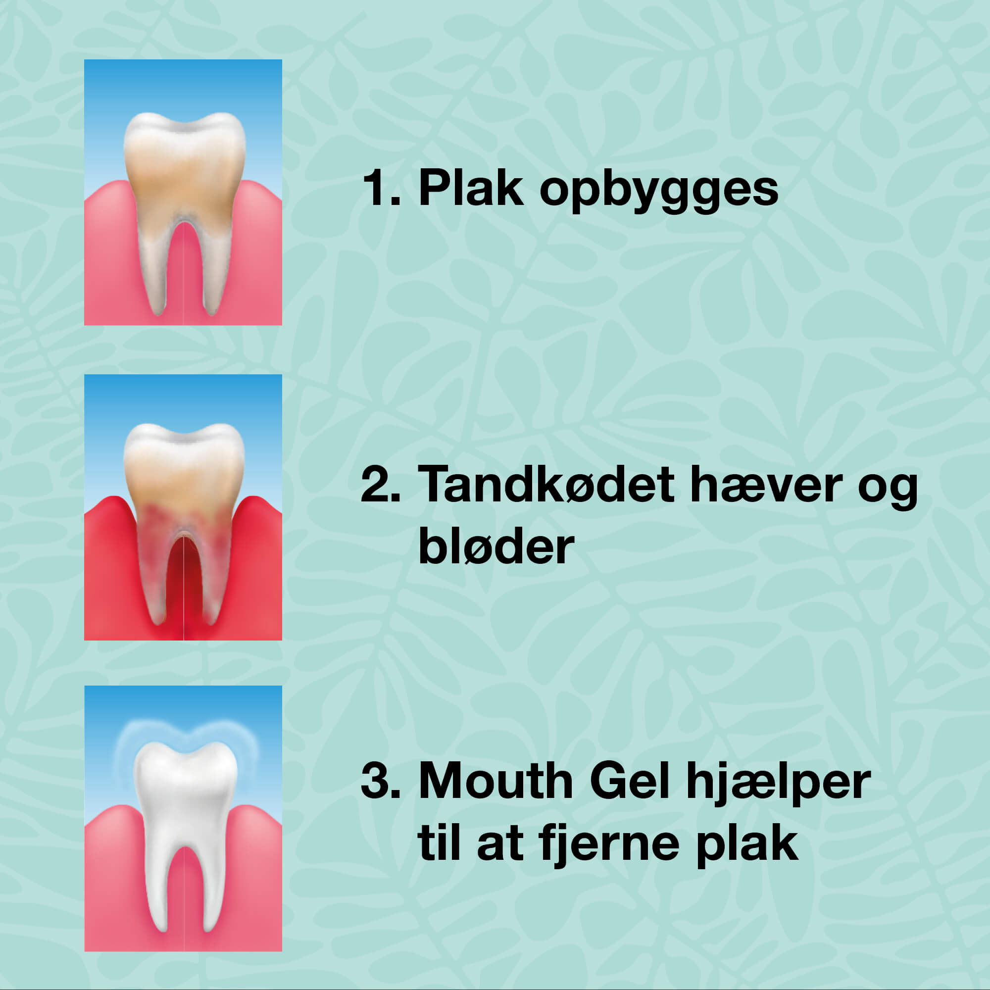 Startpakket - 5 mondproducten — Startpakket voor een goede mondhygiëne en verzorging van parodontitis en schimmel