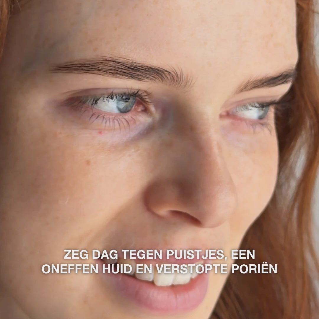 Salicylzuur serum voor mee-eters, vette huid en verstopte poriën — Salicylzuur serum bij vette huid, mee-eters en poriën. Met Zinc PCA, groene thee, hyaluronzuur en hydraterende glycerine.