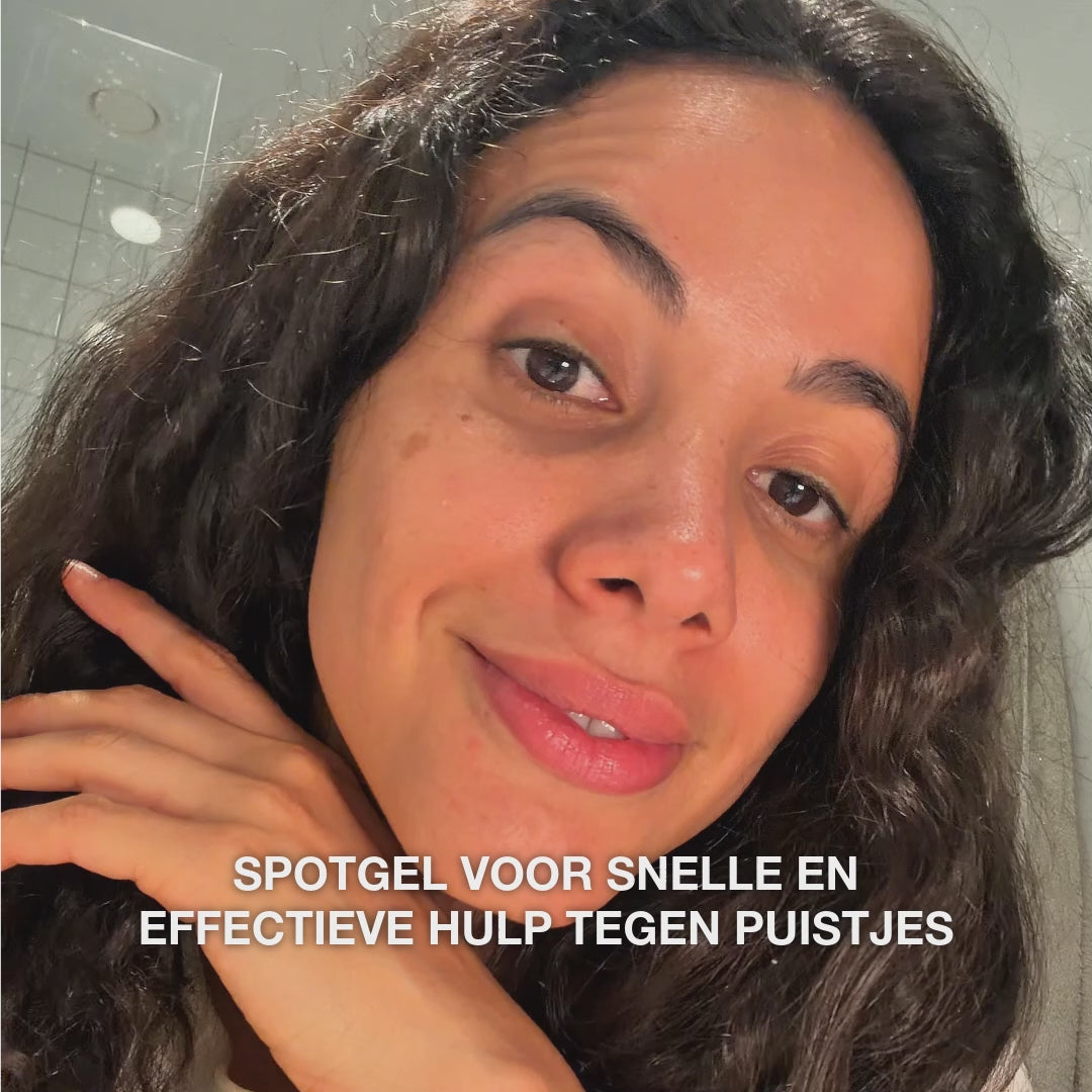 Salicylzuur Spot Gel tegen puistjes en verstopte poriën — Salicylzuur Spot Gel zuivert en balanceert de huid. Verwijdert overtollig talg en dode huidcellen met salicylzuur.