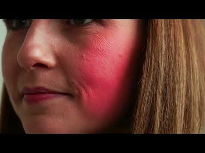 Panthenol serum voor een gevoelige huid en roodheid - Serum met provitamine B5 & niacinamide verzacht roodheid & rosacea